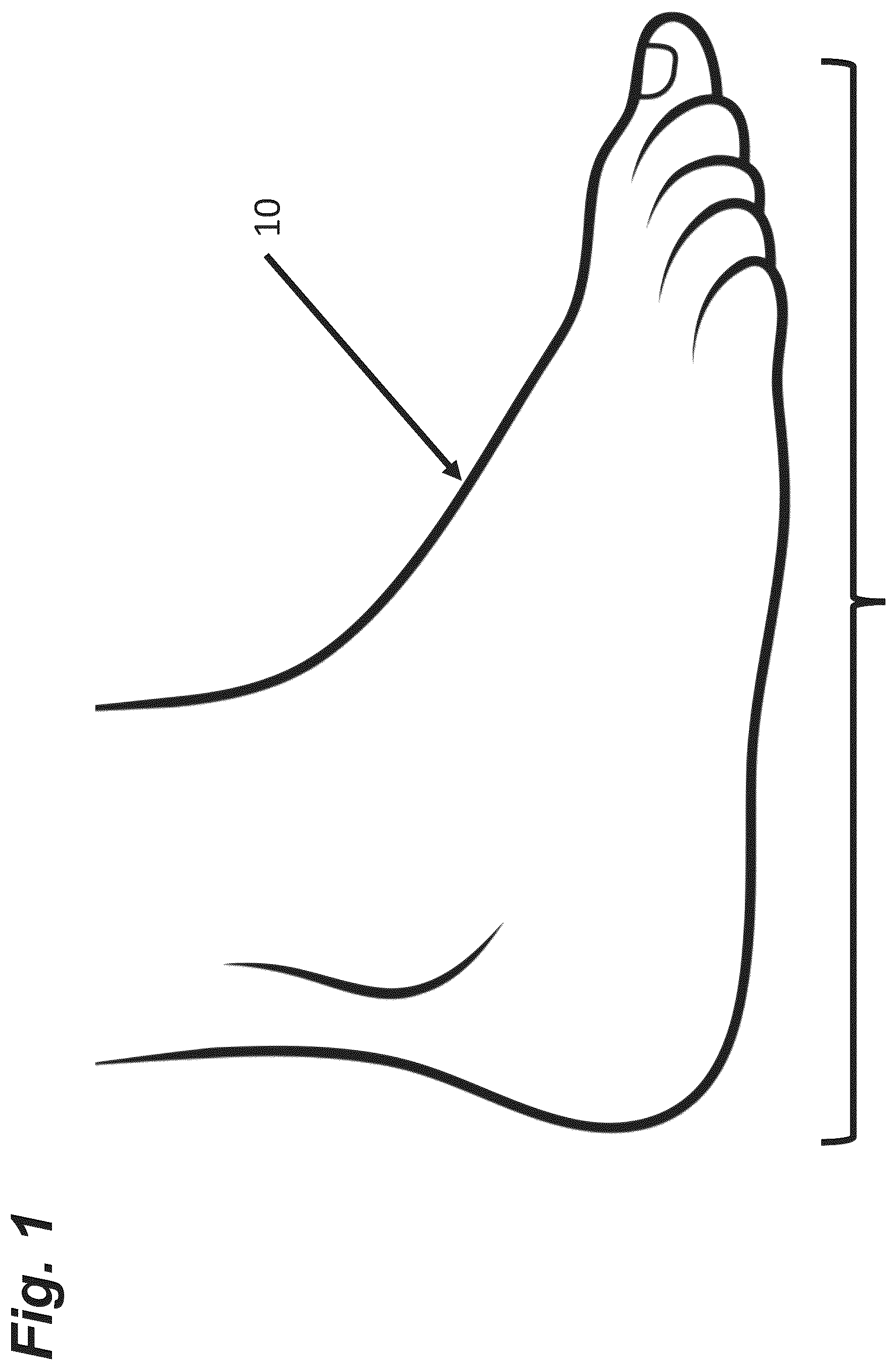 Patent US12496007 Figure 1 – Apparatus and method for monitoring peripheral diabetic neuropathy and/or peripheral arterial disease