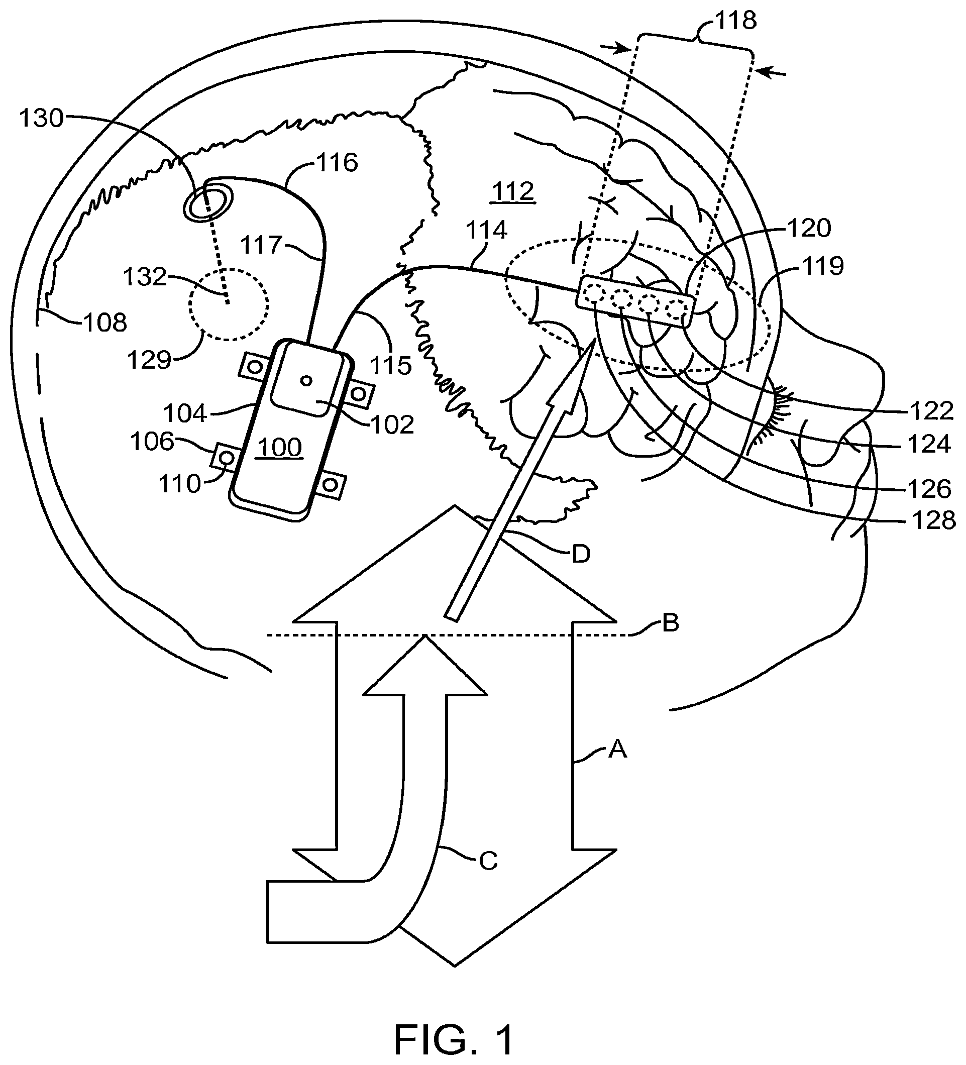 Patent US12496011 Figure 1 – Systems and methods for assessing the effectiveness of a therapy including a drug regimen using an implantable medical device