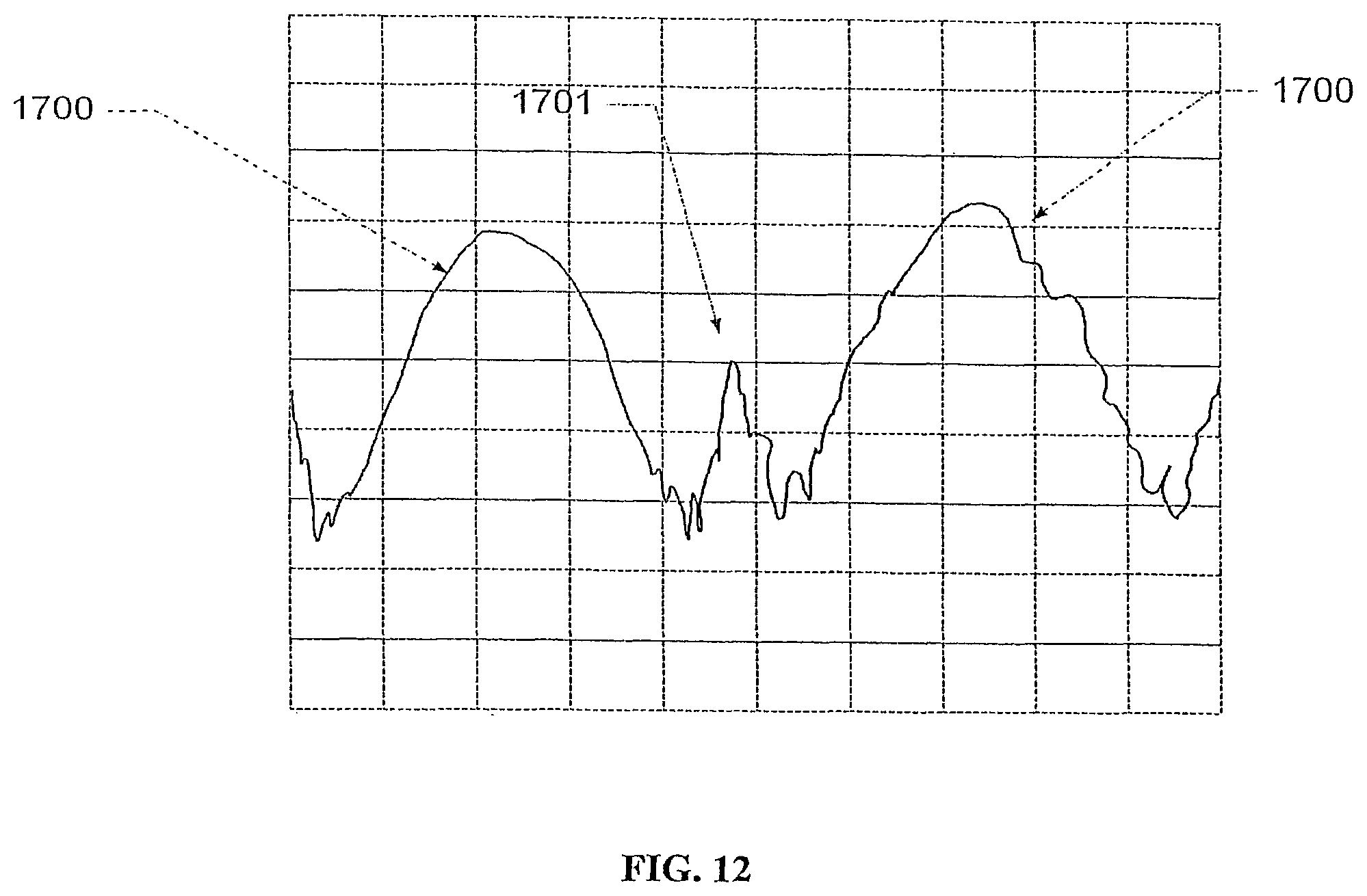 Patent US12496012 Figure 16 – Scanned laser vein contrast enhancer with eye safety protection with respect to emitted laser light