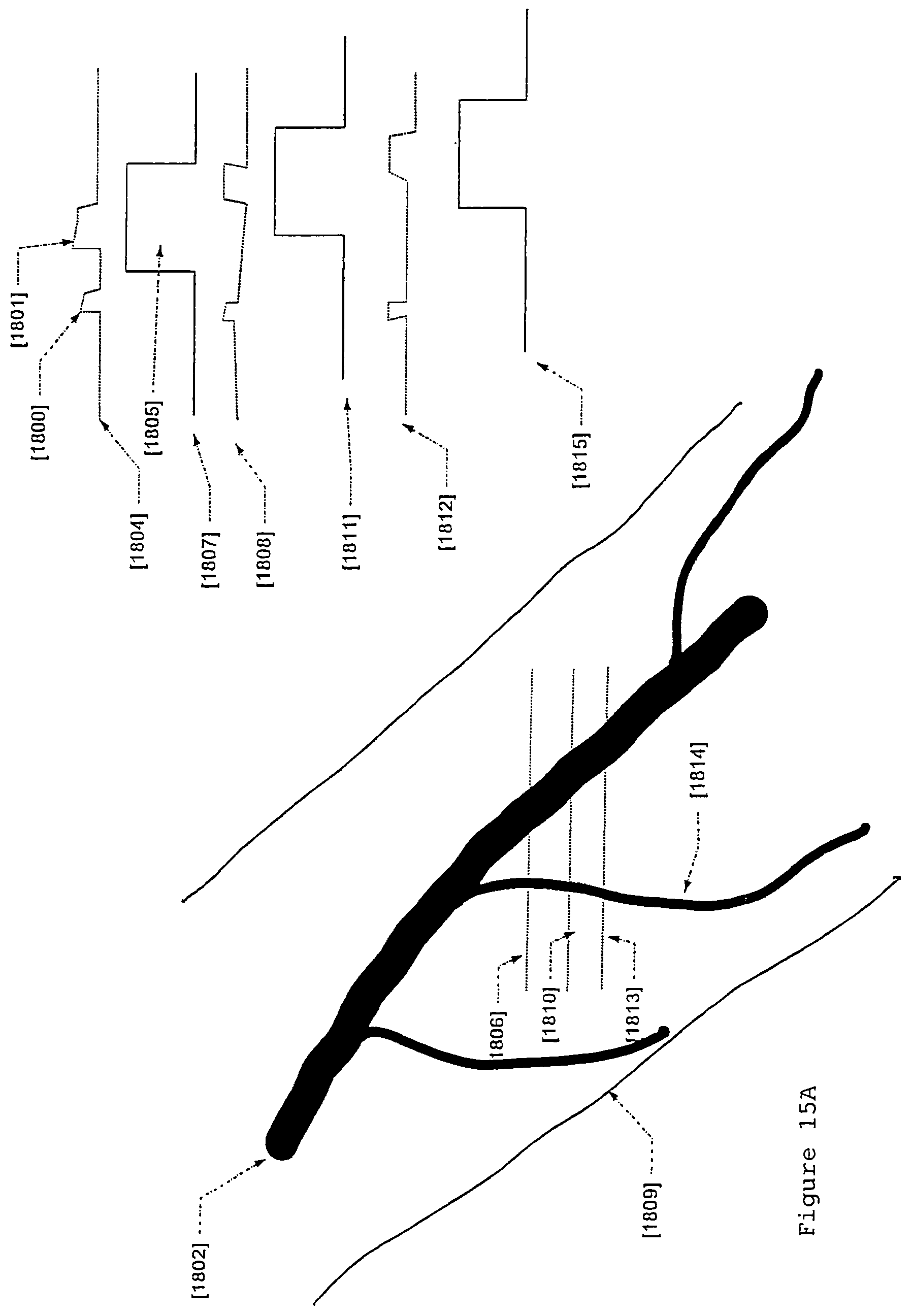 Patent US12496012 Figure 18 – Scanned laser vein contrast enhancer with eye safety protection with respect to emitted laser light