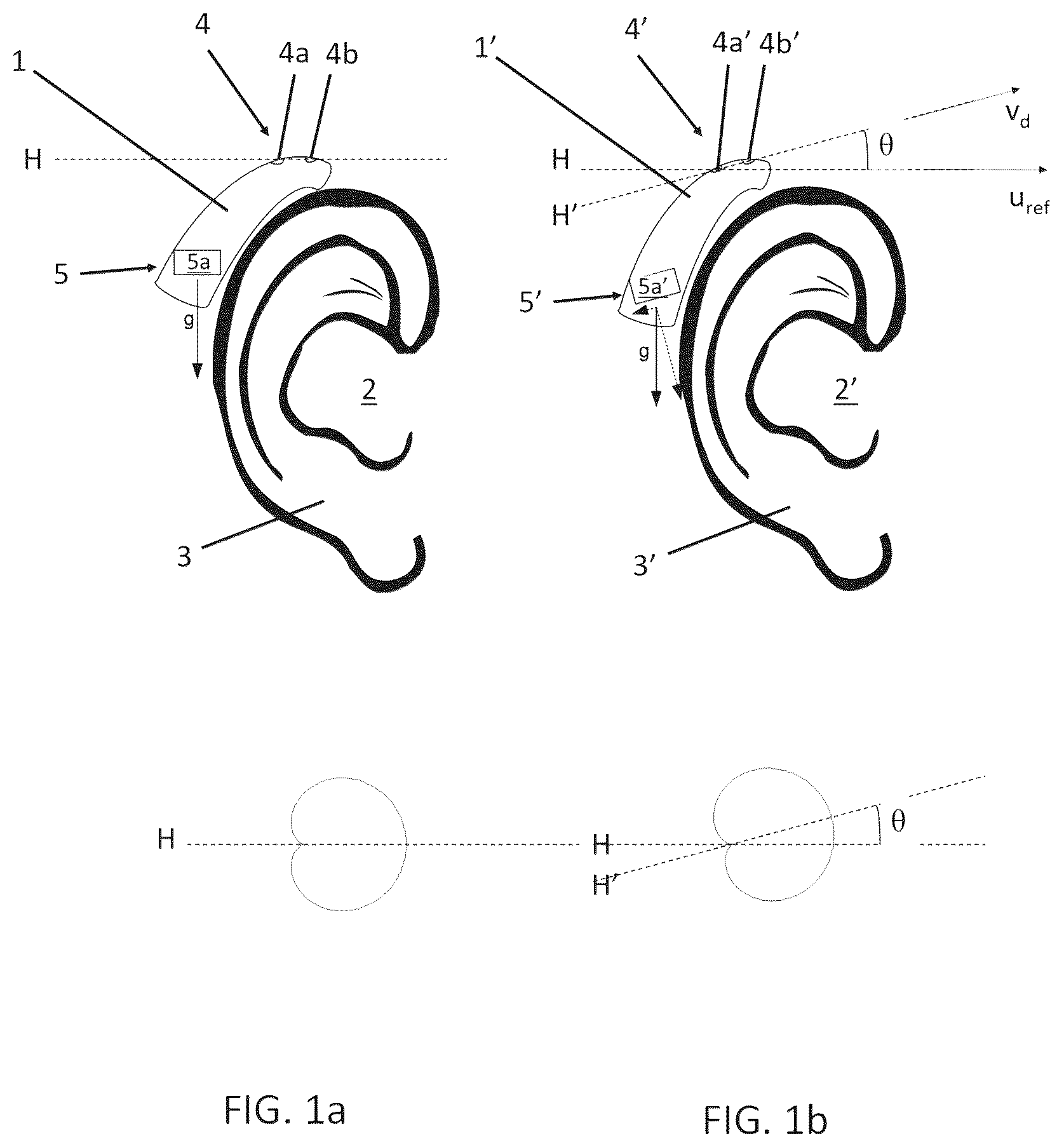 Patent US12496014 Figure 1 – Optimizing positioning and configuration of a hearing device