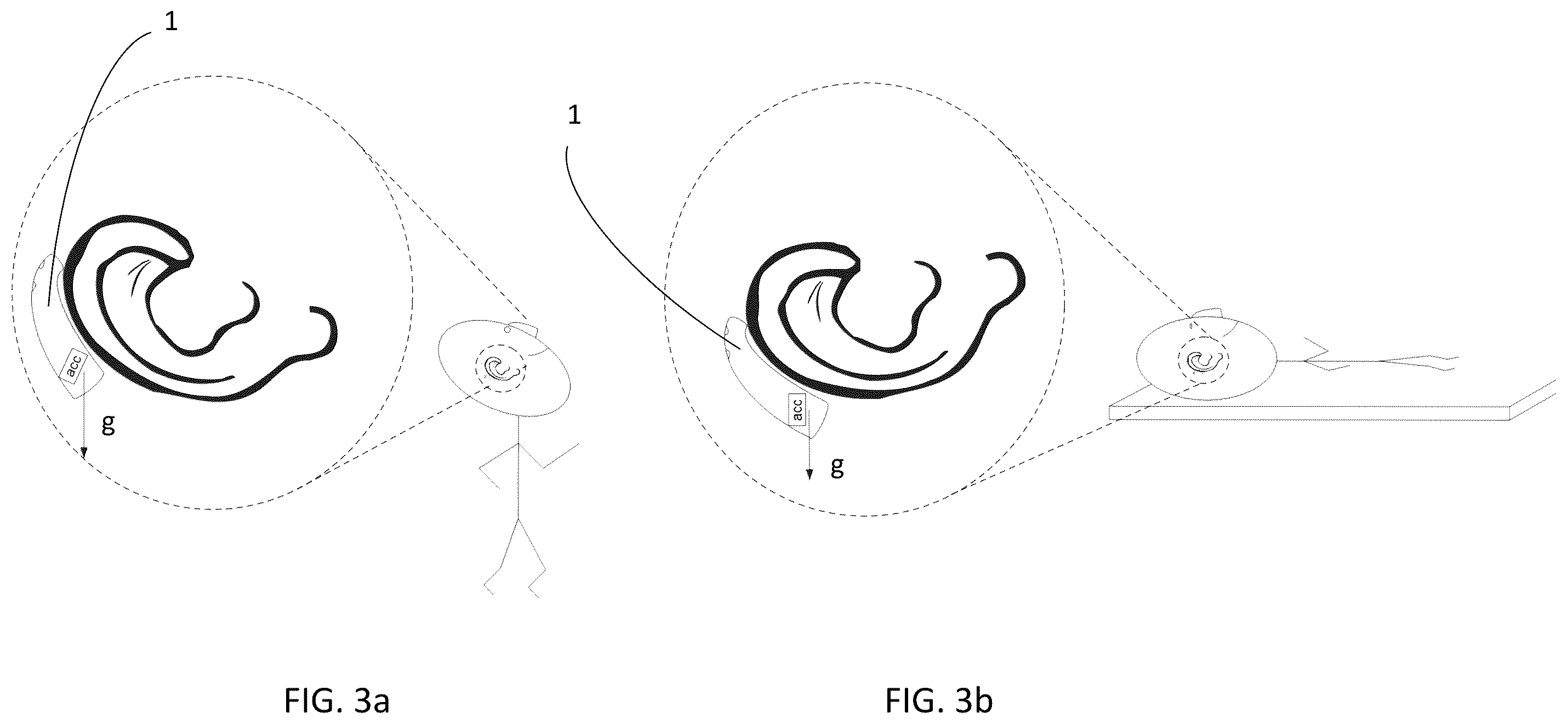 Patent US12496014 Figure 3 – Optimizing positioning and configuration of a hearing device
