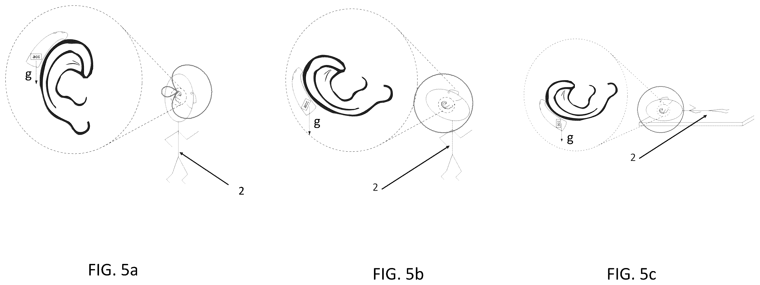 Patent US12496014 Figure 5 – Optimizing positioning and configuration of a hearing device