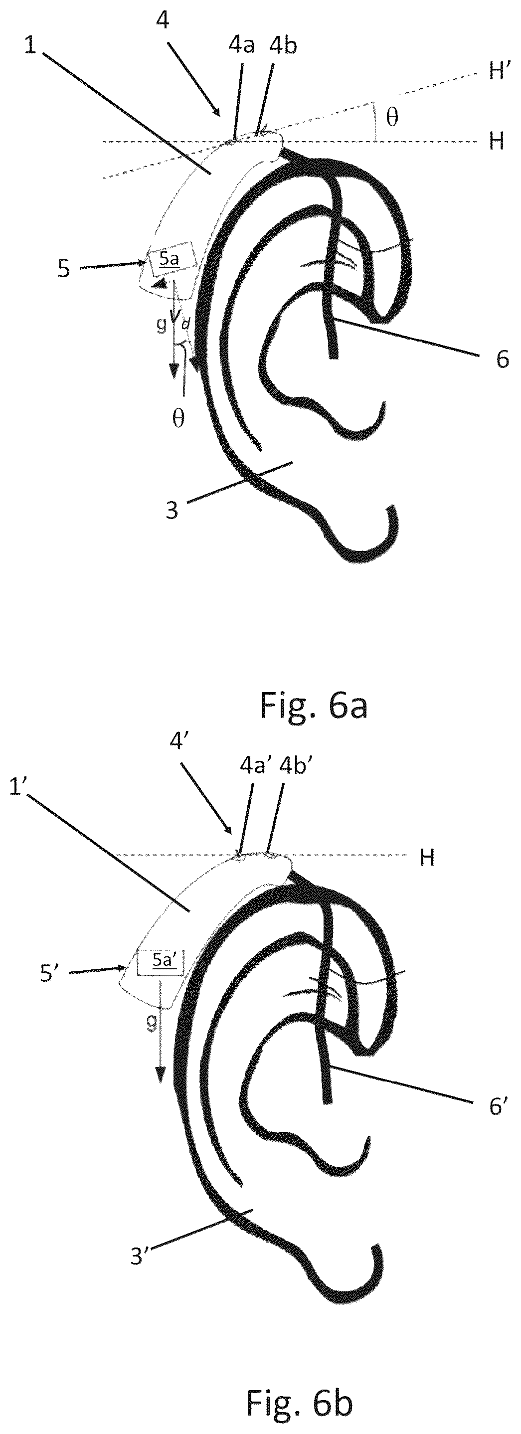Patent US12496014 Figure 6 – Optimizing positioning and configuration of a hearing device