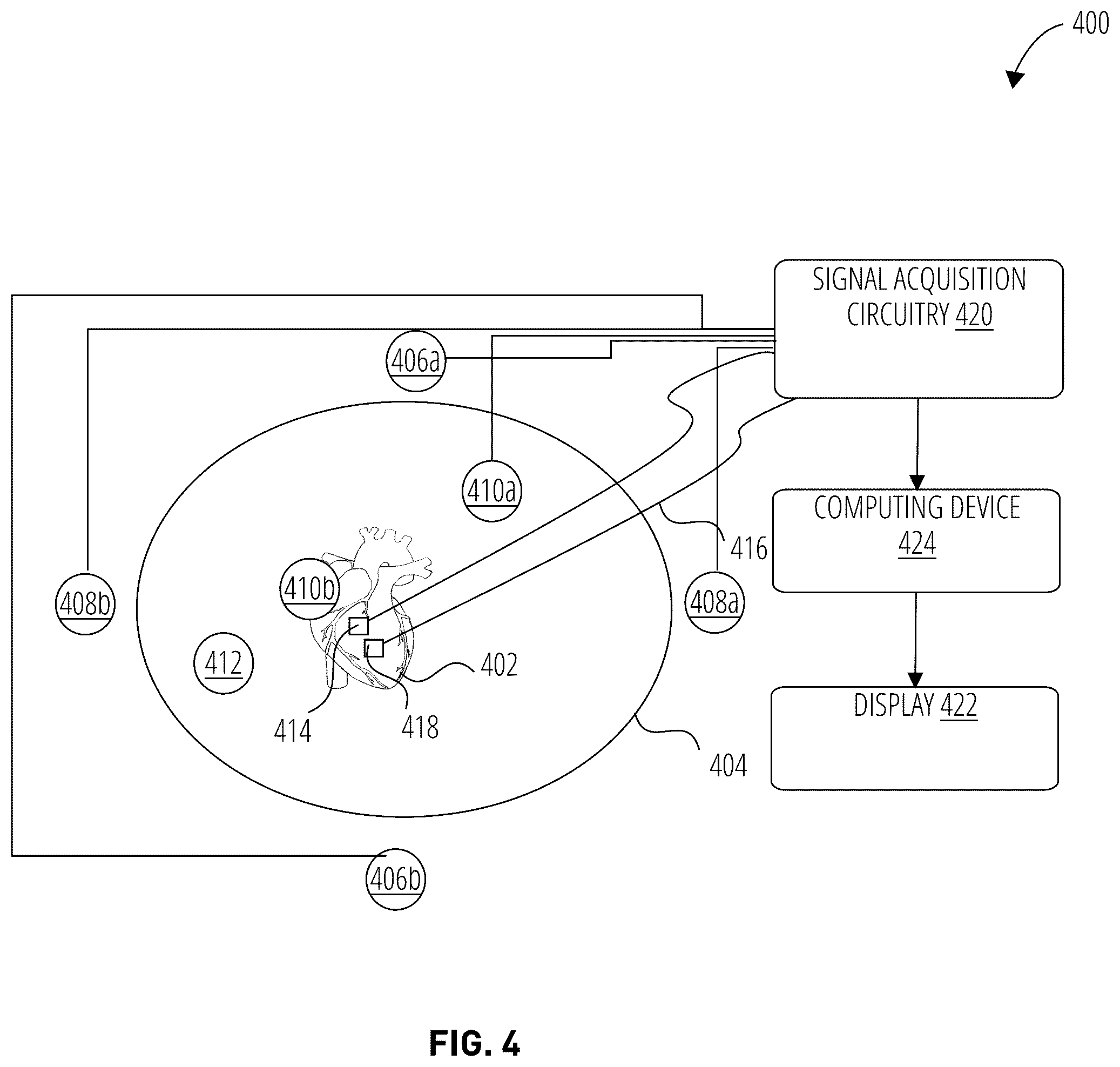 Patent US12496017 Figure 5 – Removal of cardiac and respiratory motion from geometric points acquired from cardiac catheter electrodes
