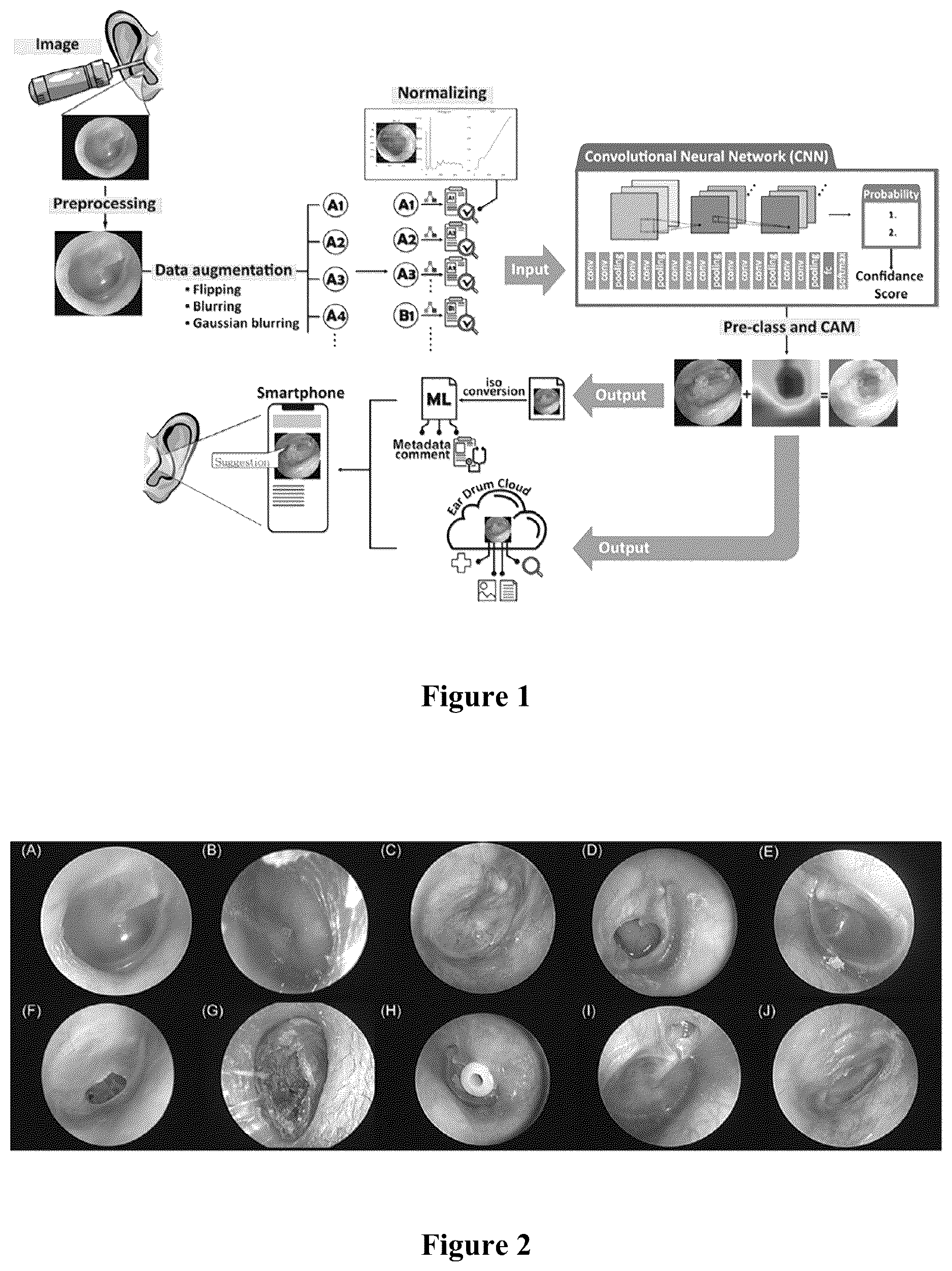 Patent US12496018 Figure 1 – System and method for automatic diagnosis of middle ear diseases from an otoscopic image