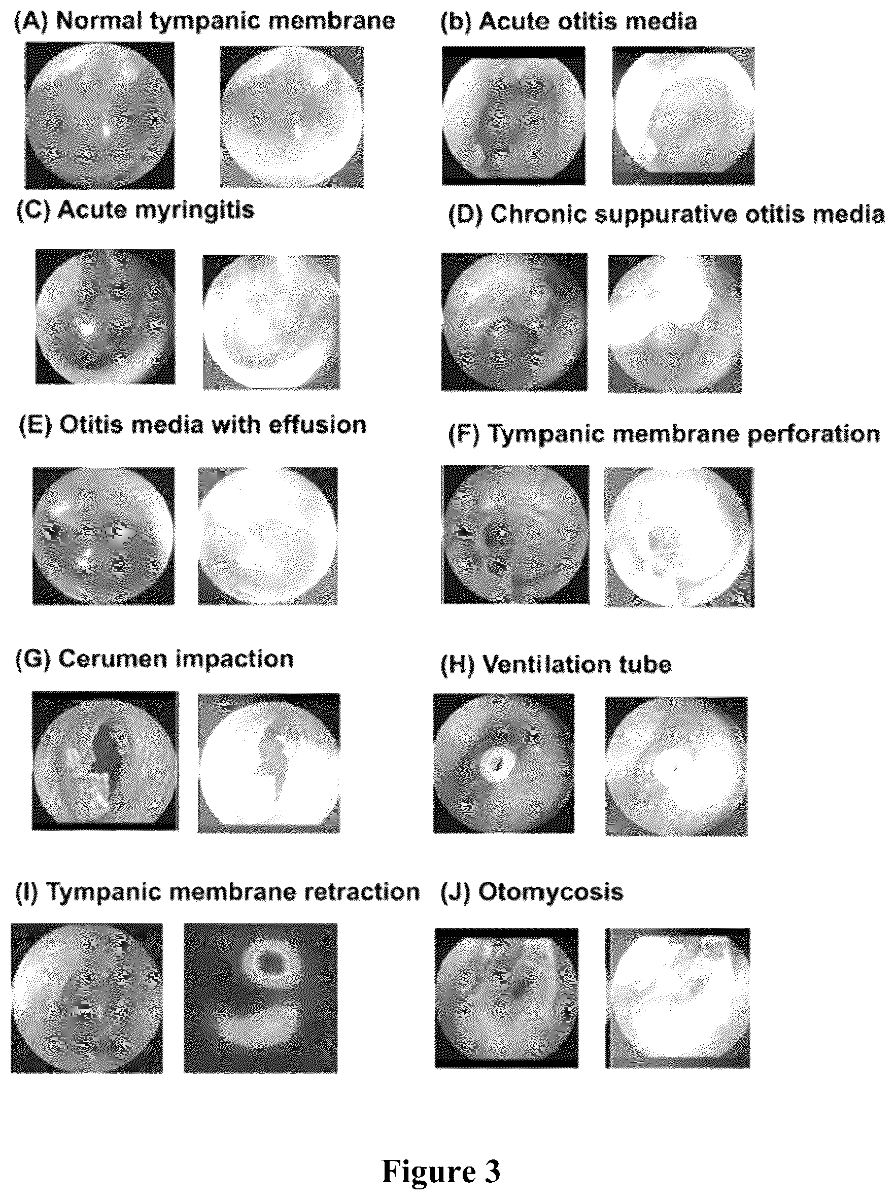 Patent US12496018 Figure 2 – System and method for automatic diagnosis of middle ear diseases from an otoscopic image