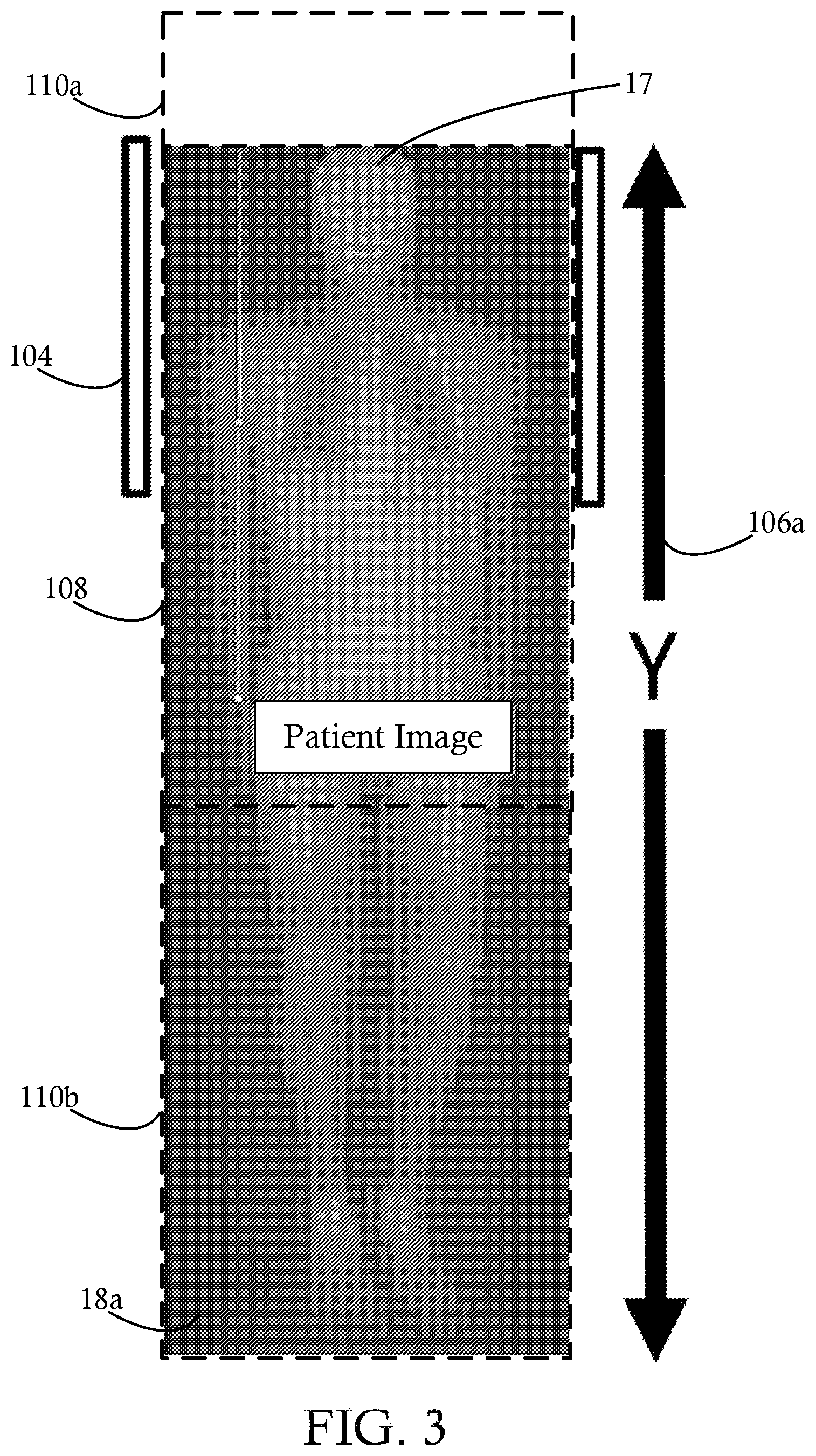 Patent US12496020 Figure 3 – High sensitivity continuous bed motion