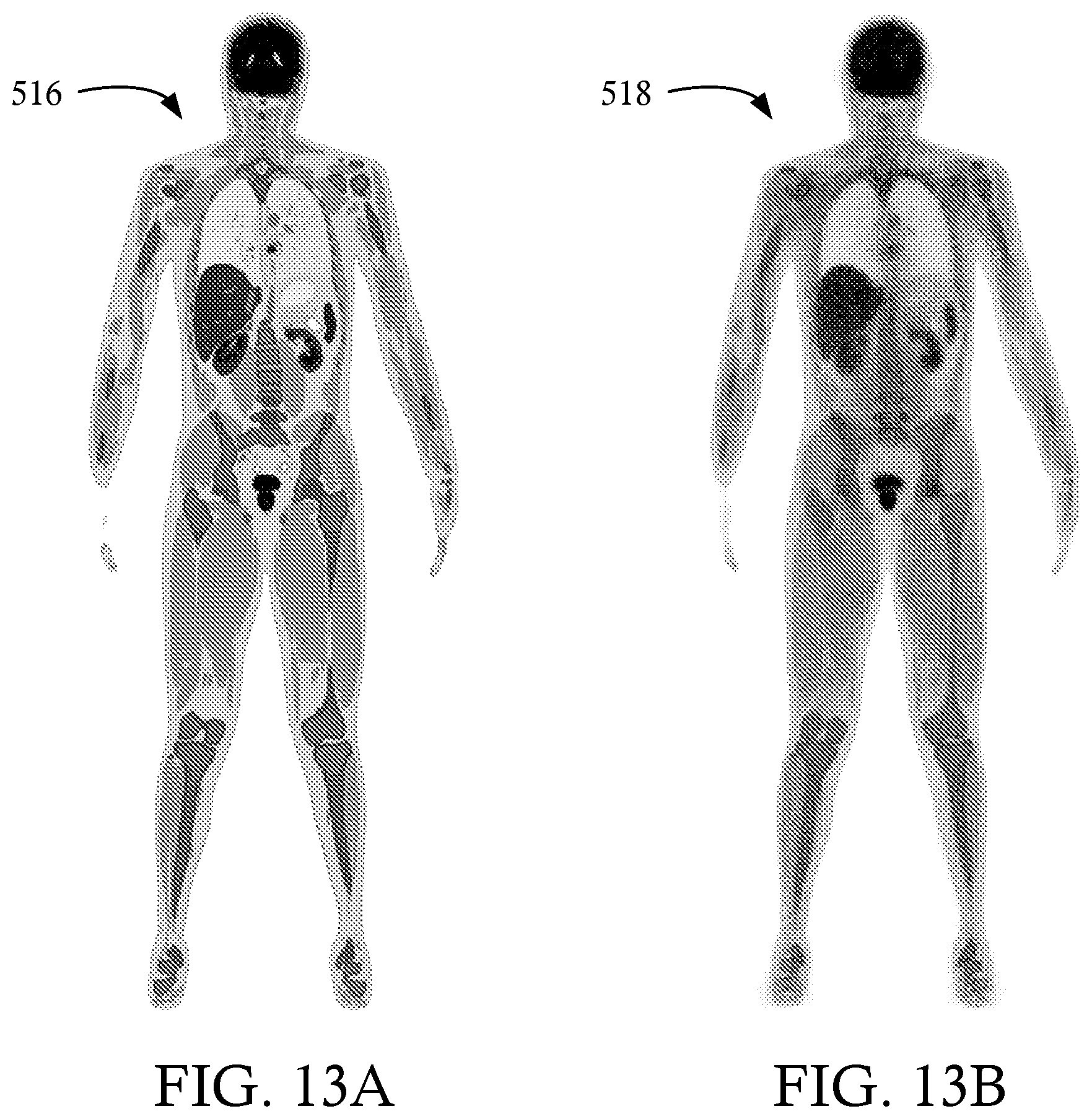 Patent US12496020 Figure 14 – High sensitivity continuous bed motion
