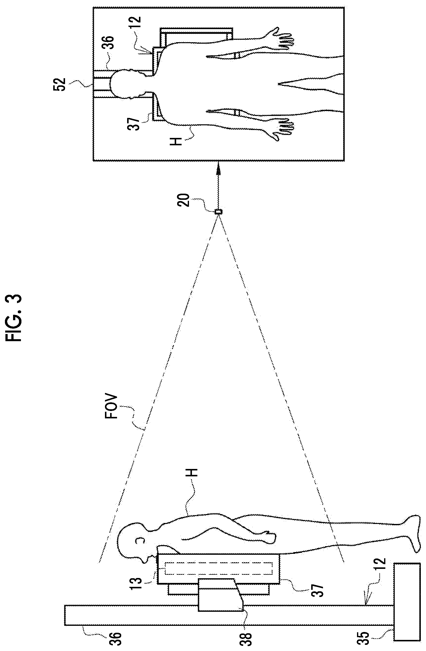 Patent US12496022 Figure 3 – Imaging support apparatus, operation method of imaging support apparatus, and operation program of imaging support apparatus