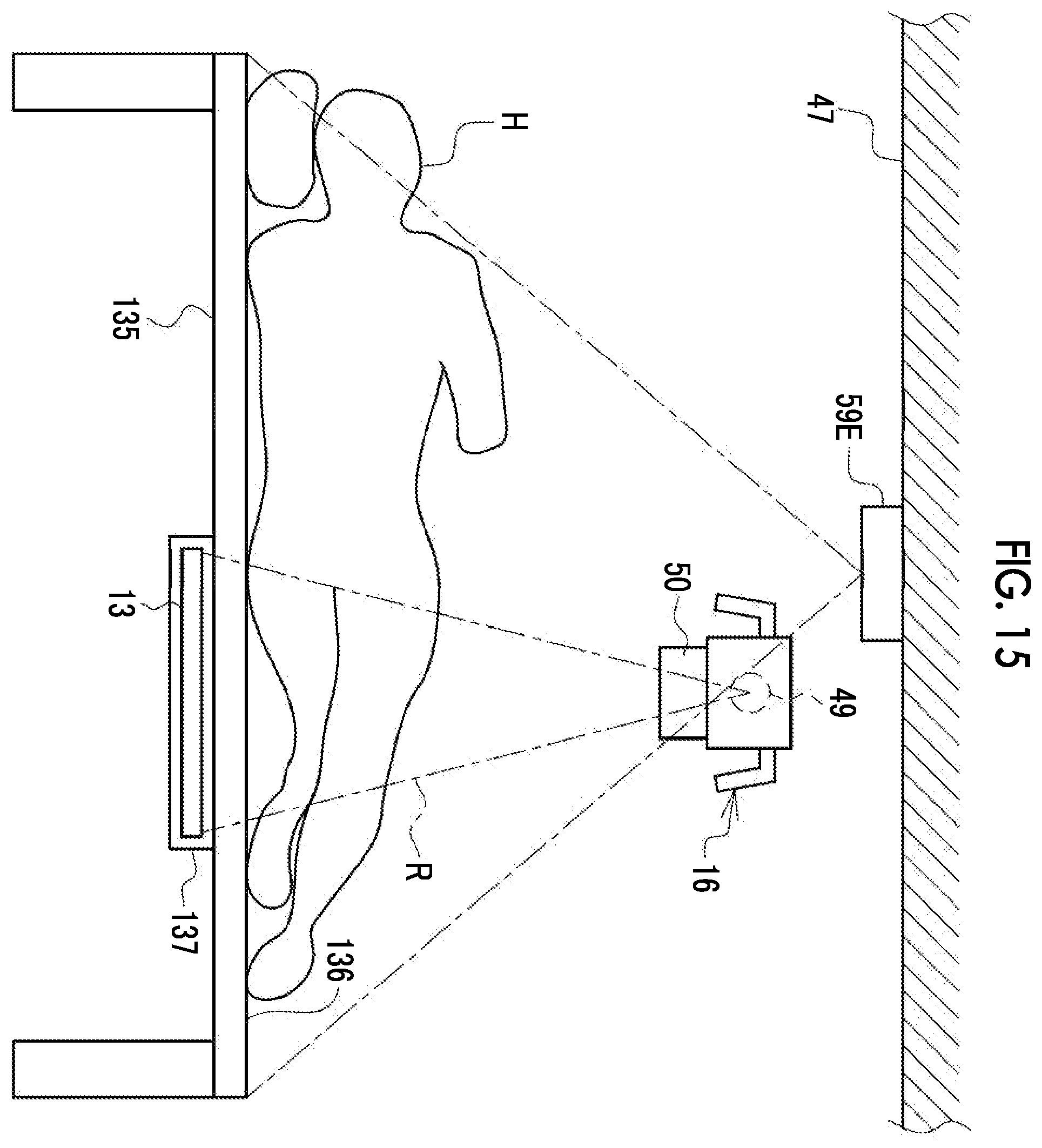 Patent US12496022 Figure 15 – Imaging support apparatus, operation method of imaging support apparatus, and operation program of imaging support apparatus