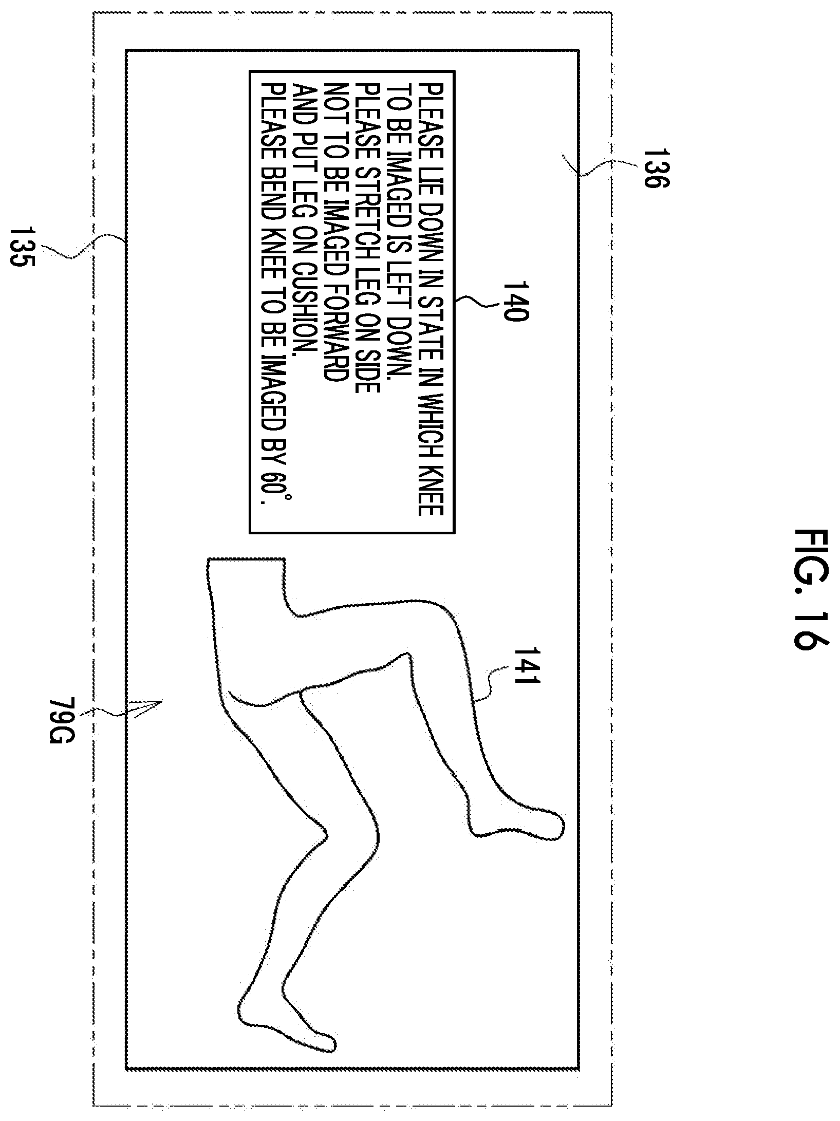 Patent US12496022 Figure 16 – Imaging support apparatus, operation method of imaging support apparatus, and operation program of imaging support apparatus