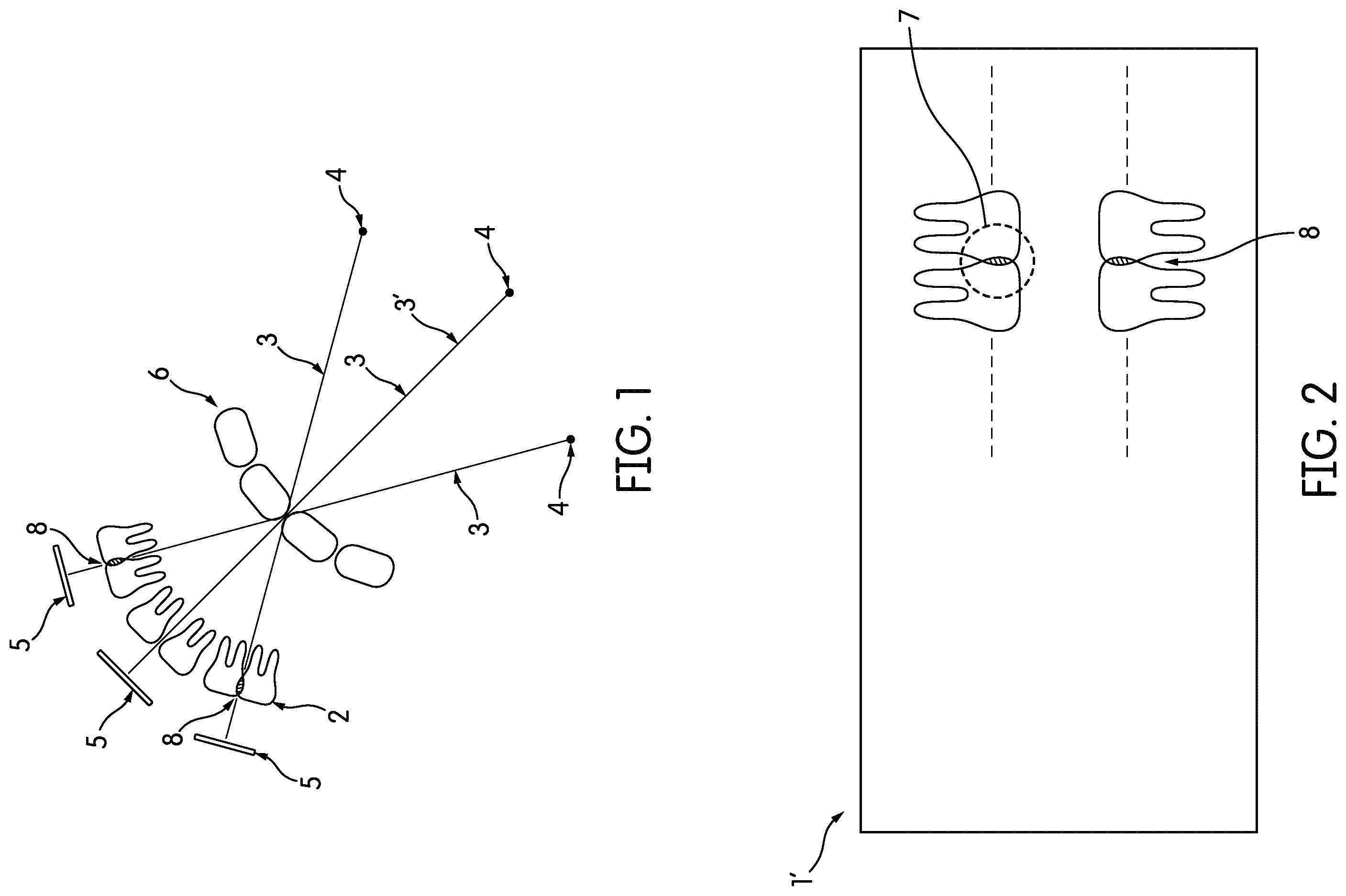 Patent US12496026 Figure 1 – X-ray imaging method and system for reducing overlapping of neighboring teeth in panoramic images