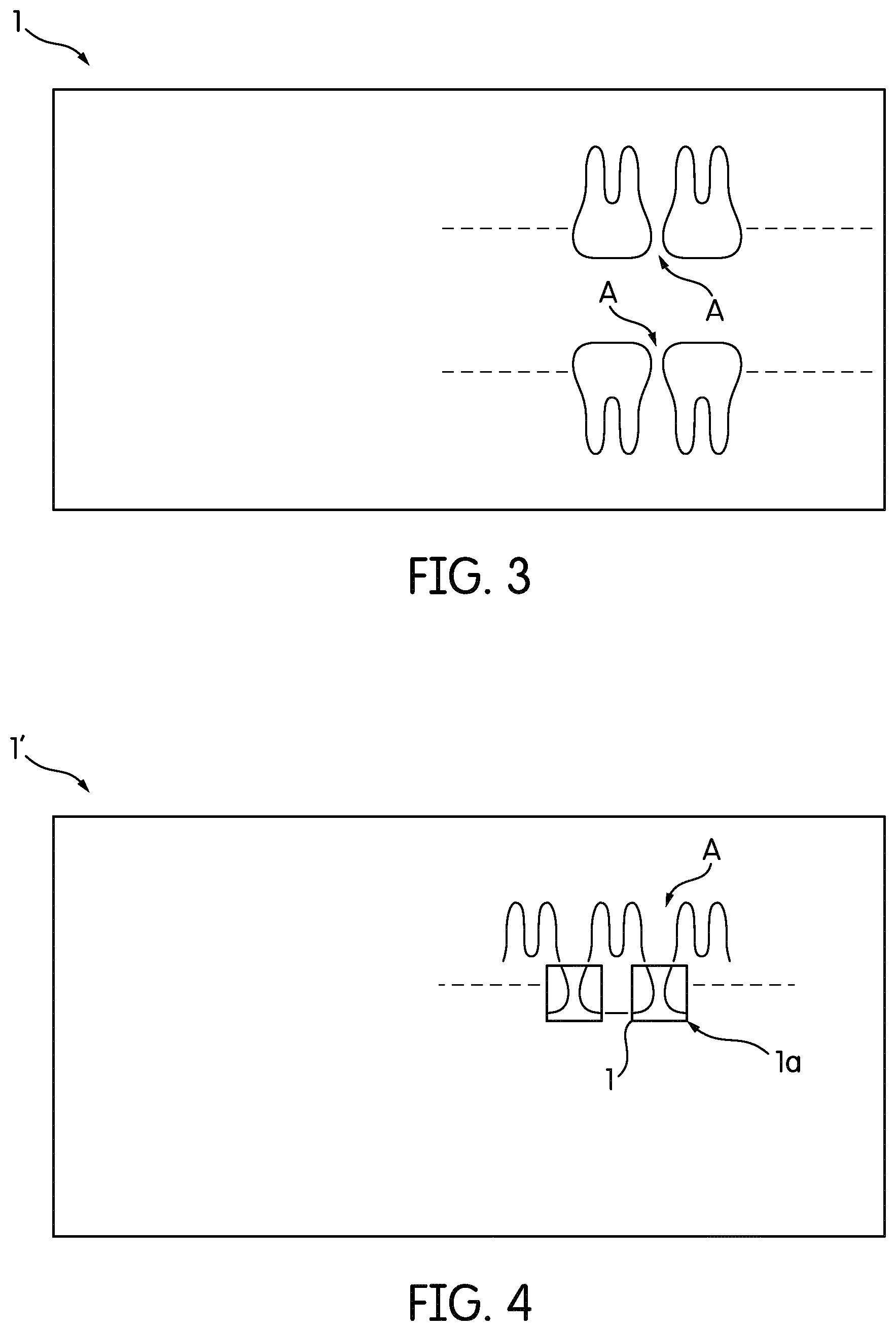 Patent US12496026 Figure 2 – X-ray imaging method and system for reducing overlapping of neighboring teeth in panoramic images