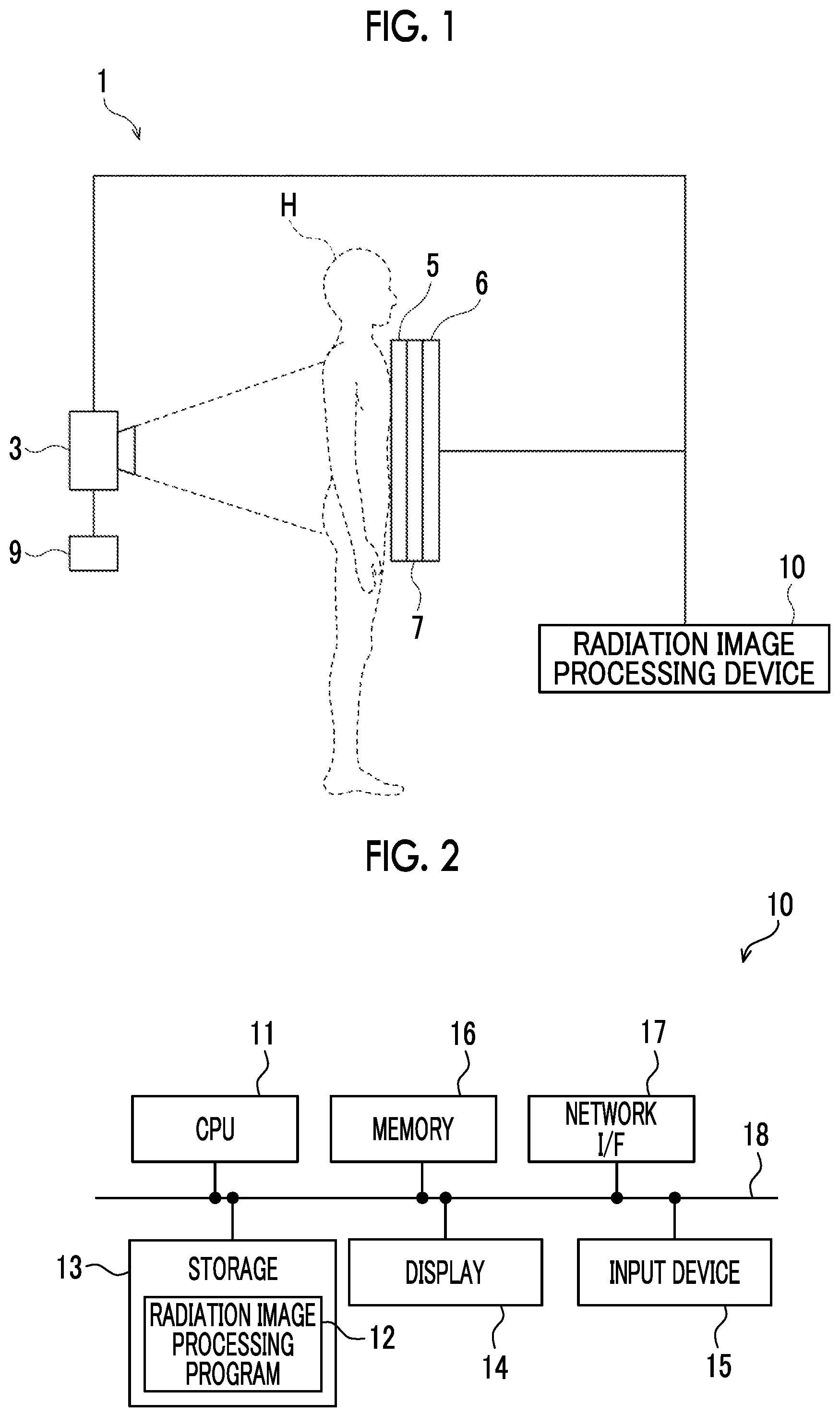 Patent US12496028 Figure 1 – Radiation image processing device, radiation image processing method, and radiation image processing program