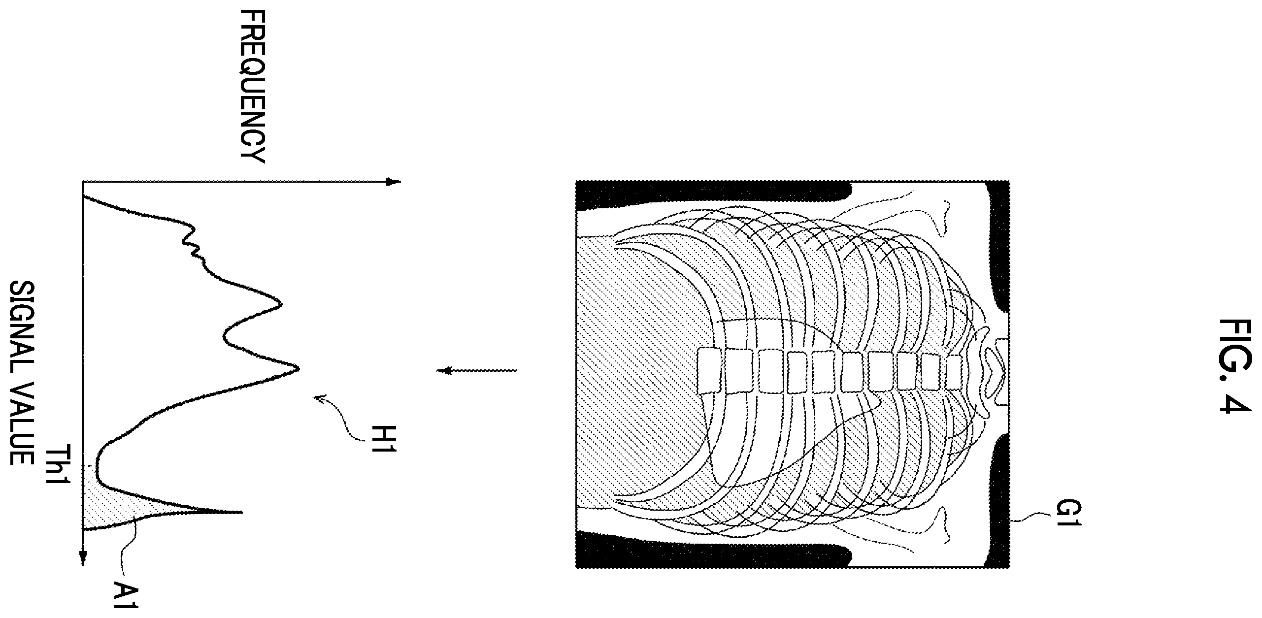 Patent US12496028 Figure 3 – Radiation image processing device, radiation image processing method, and radiation image processing program