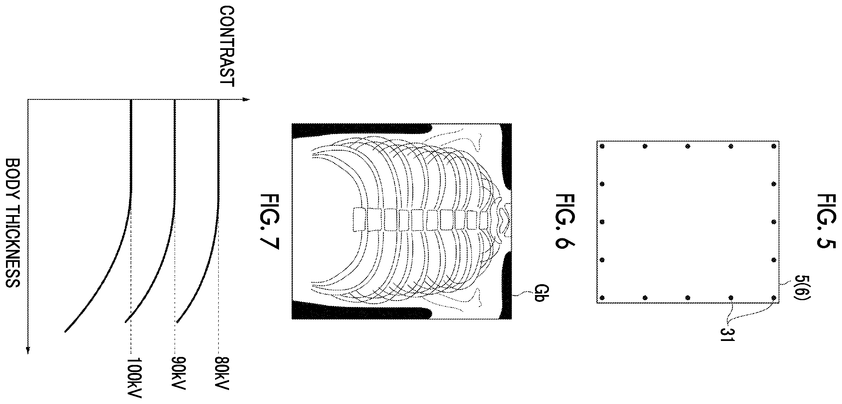 Patent US12496028 Figure 4 – Radiation image processing device, radiation image processing method, and radiation image processing program
