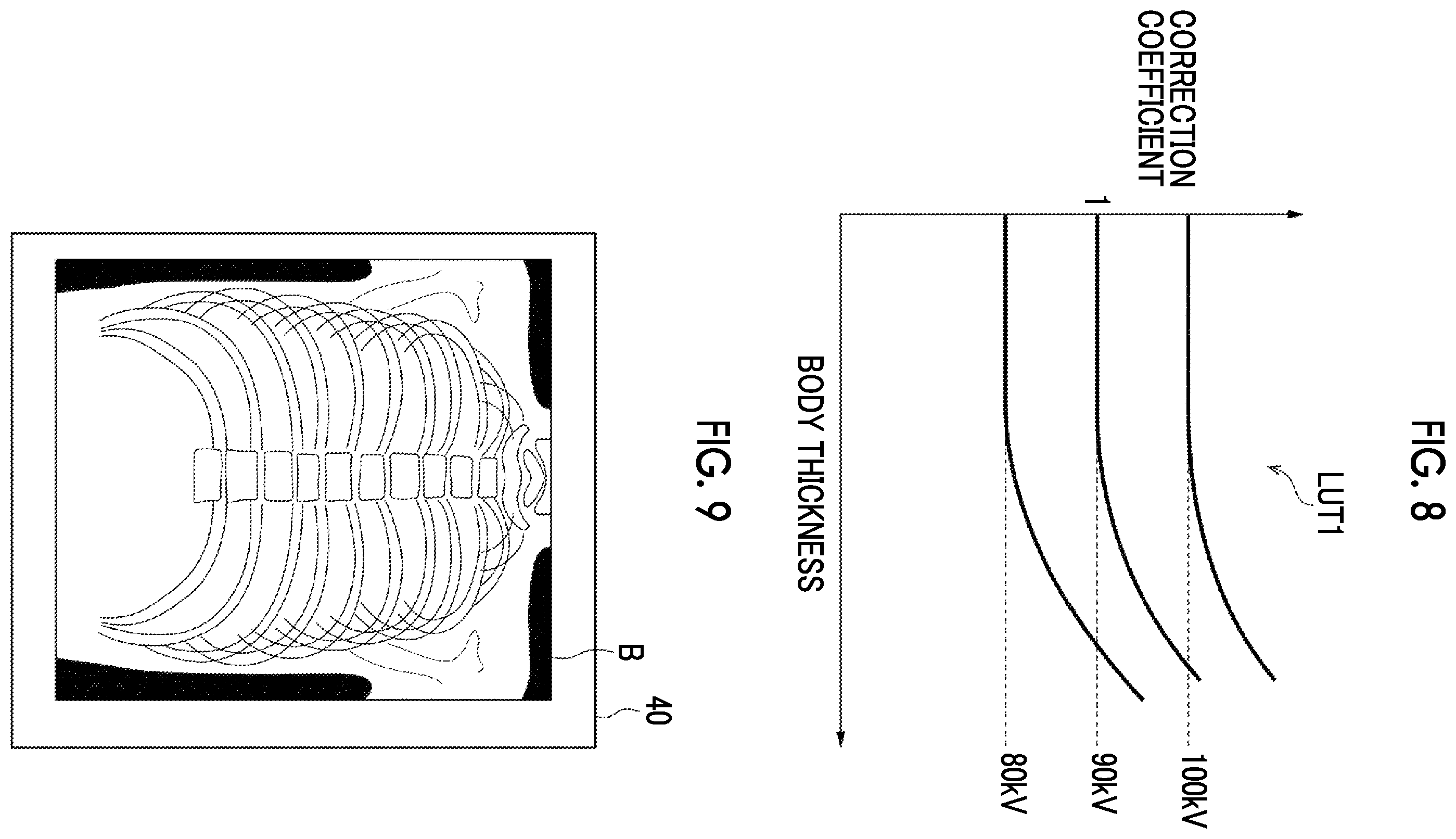 Patent US12496028 Figure 5 – Radiation image processing device, radiation image processing method, and radiation image processing program