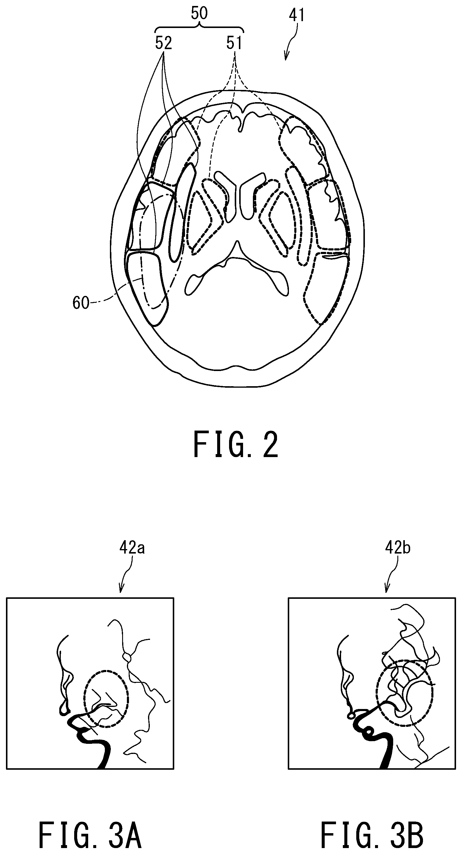 Patent US12496029 Figure 2 – Medical image processing apparatus, X-ray diagnostic apparatus, and storage medium