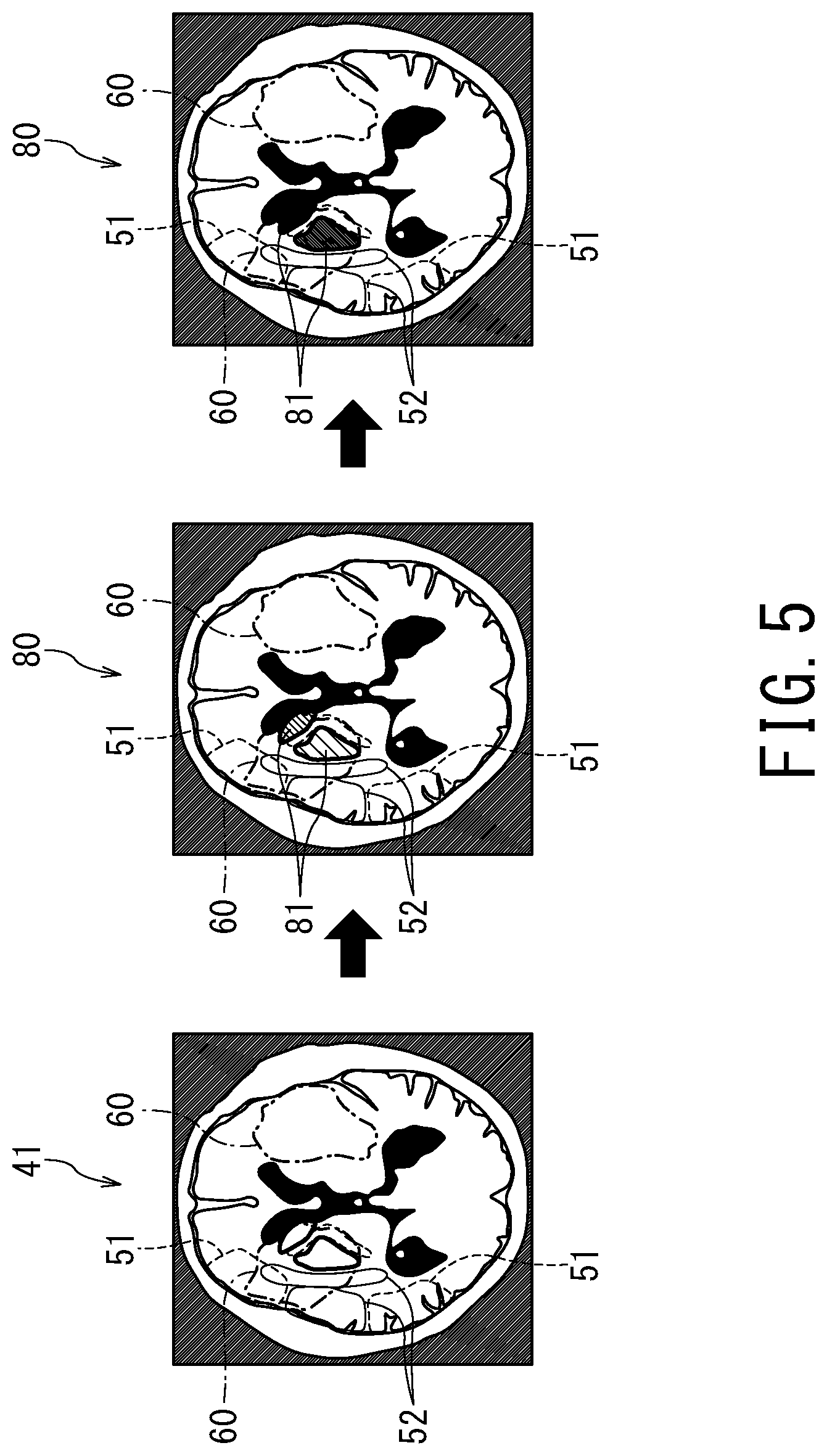 Patent US12496029 Figure 4 – Medical image processing apparatus, X-ray diagnostic apparatus, and storage medium