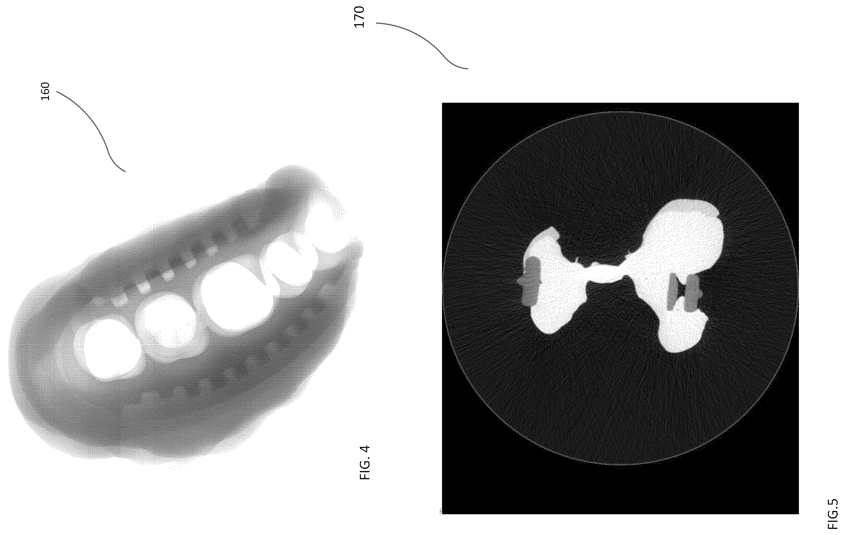 Patent US12496030 Figure 3 – Scanning dental impressions