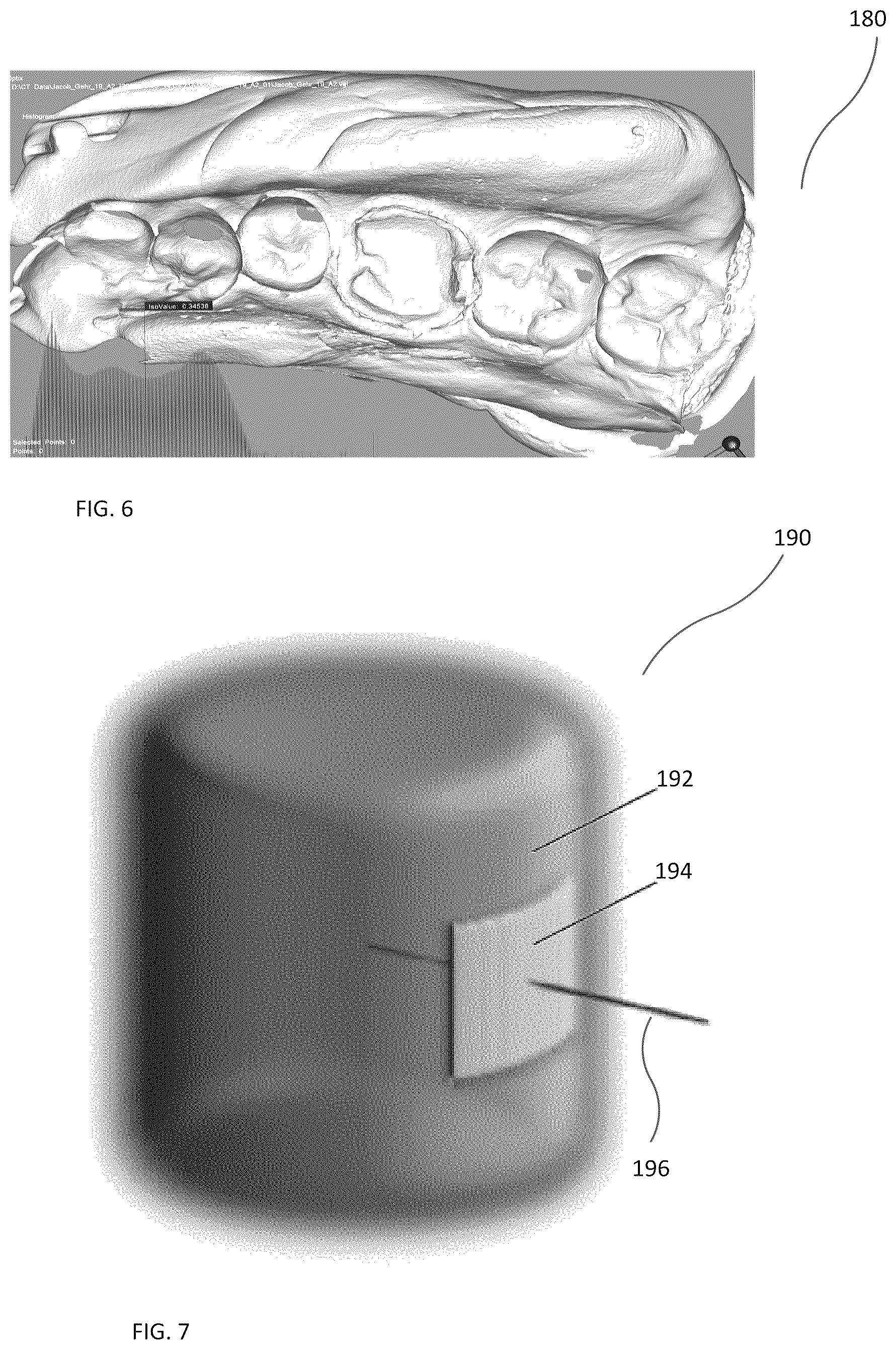 Patent US12496030 Figure 4 – Scanning dental impressions