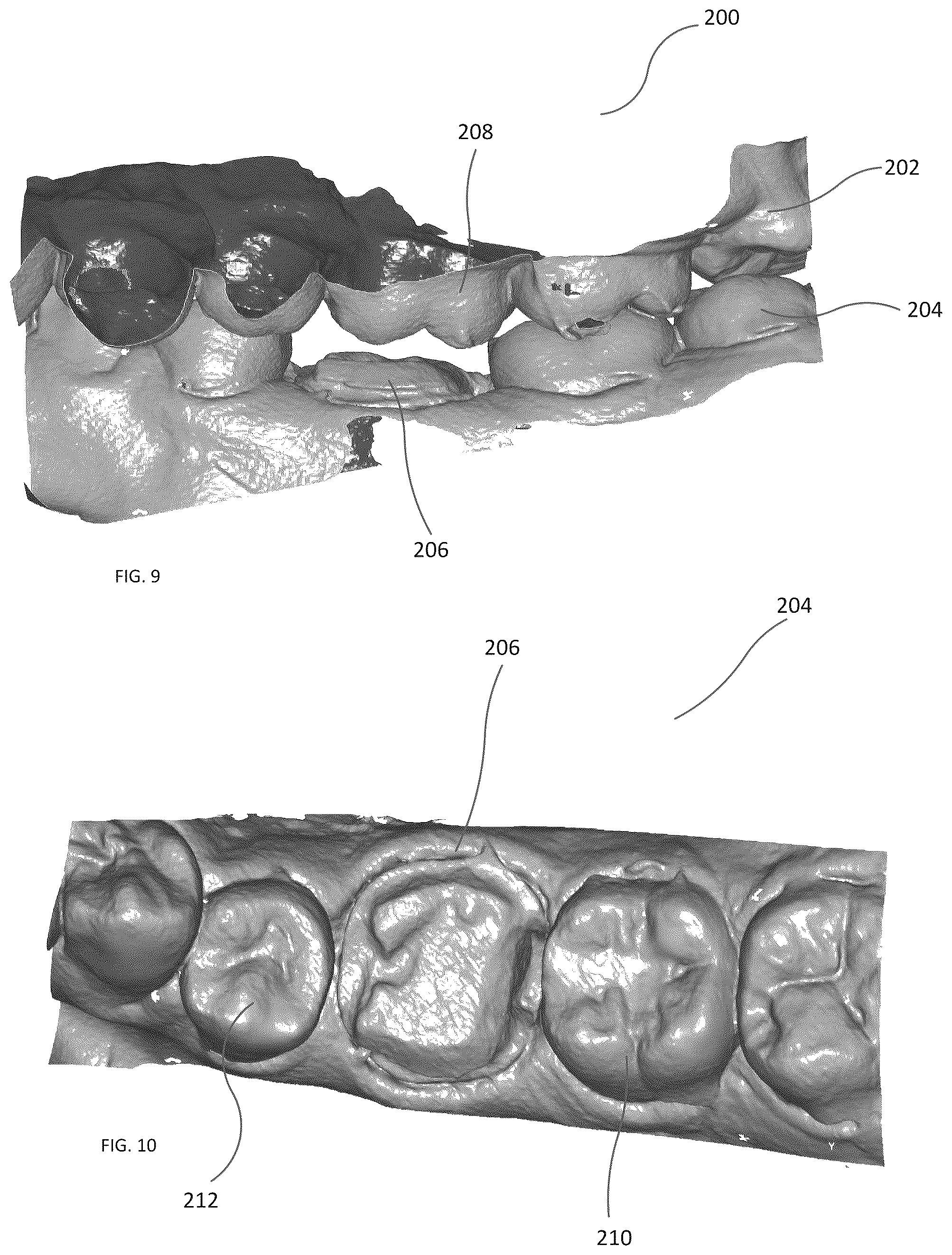 Patent US12496030 Figure 6 – Scanning dental impressions
