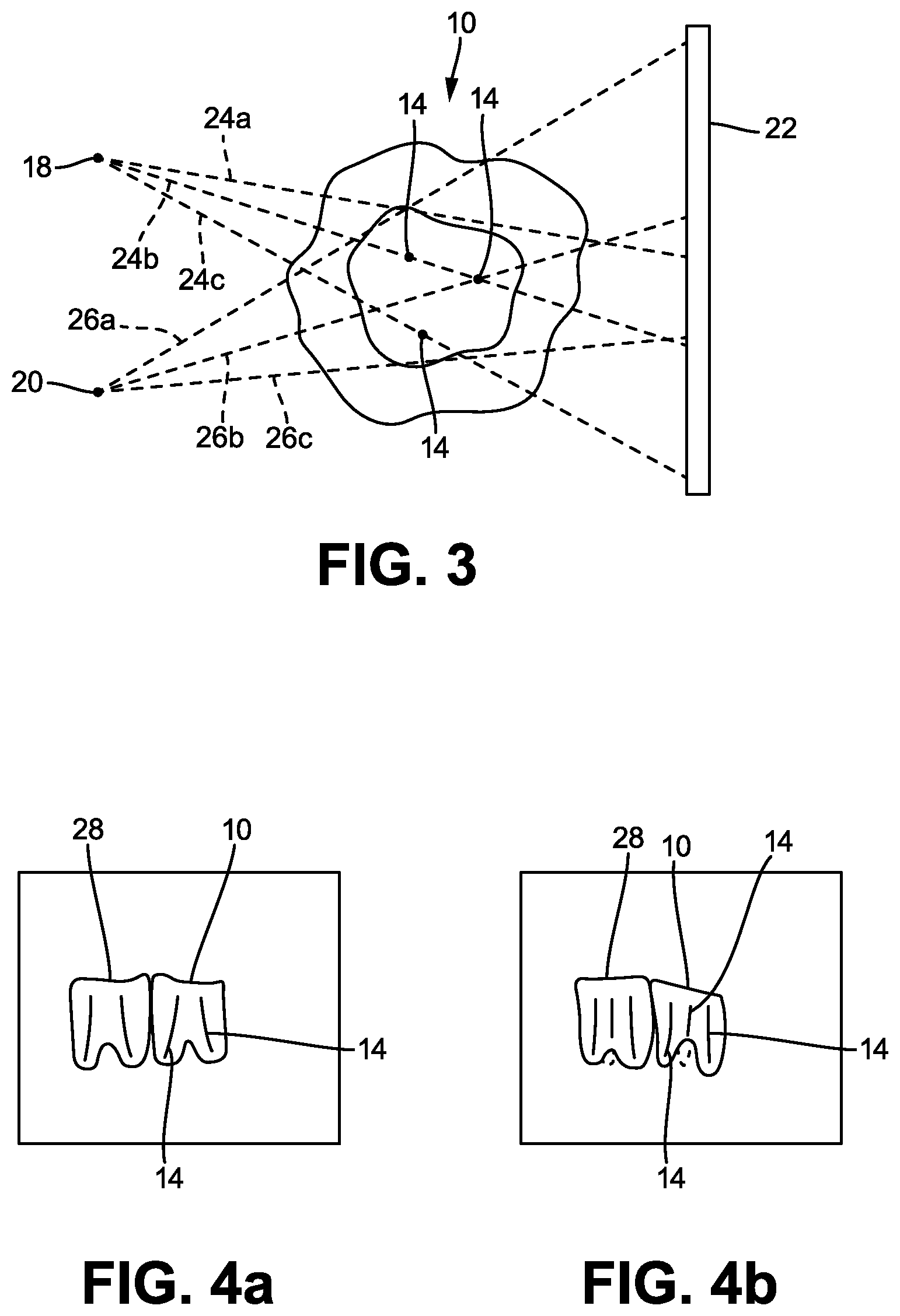 Patent US12496031 Figure 2 – Sensor holder and method for optimum positioning during intraoral imaging