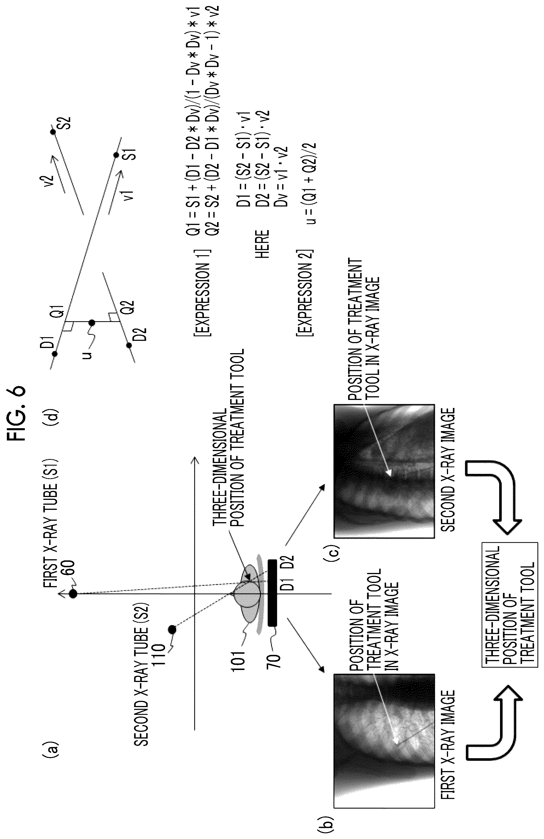 Patent US12496032 Figure 6 – X-ray imaging apparatus and X-ray imaging method