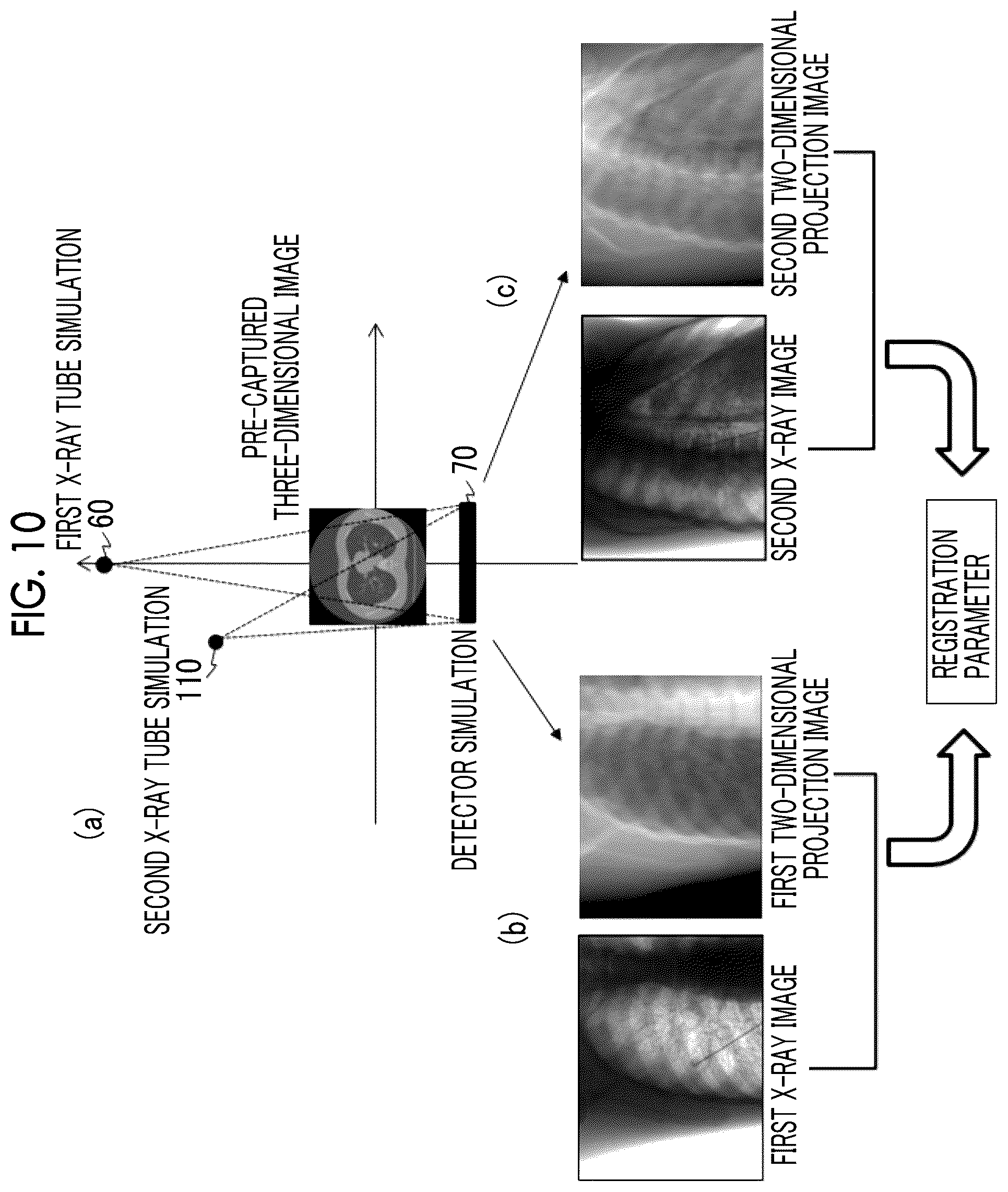 Patent US12496032 Figure 10 – X-ray imaging apparatus and X-ray imaging method