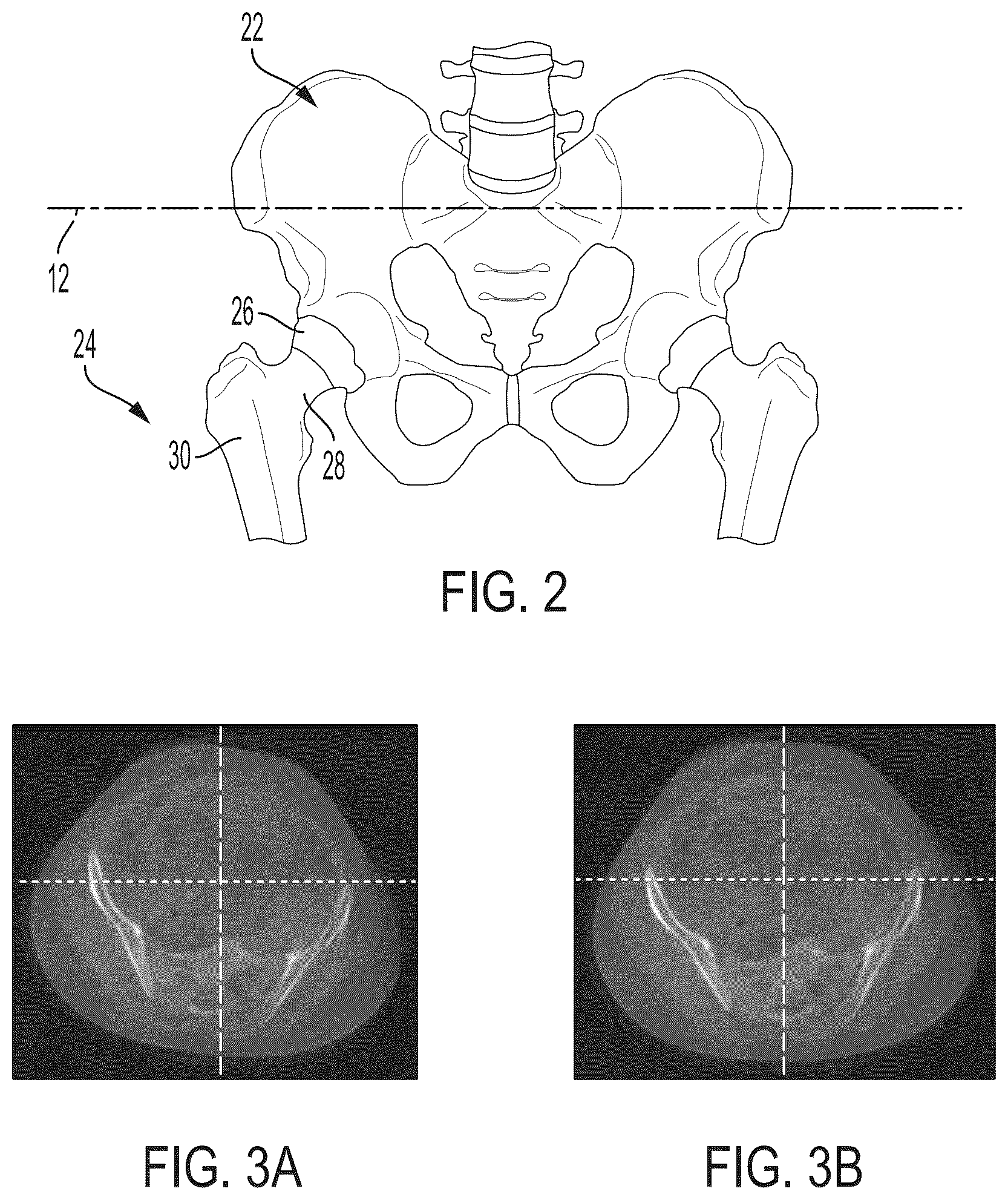 Patent US12496033 Figure 2 – For measuring the axial (transverse), coronal (frontal) and sagittal (bisection) alignment of a lower limb