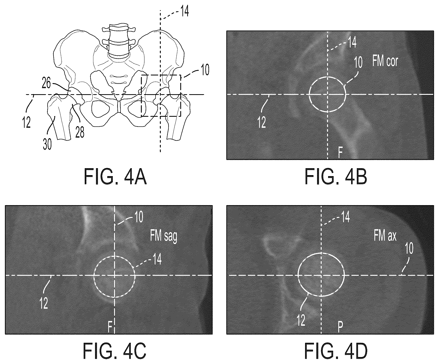 Patent US12496033 Figure 3 – For measuring the axial (transverse), coronal (frontal) and sagittal (bisection) alignment of a lower limb