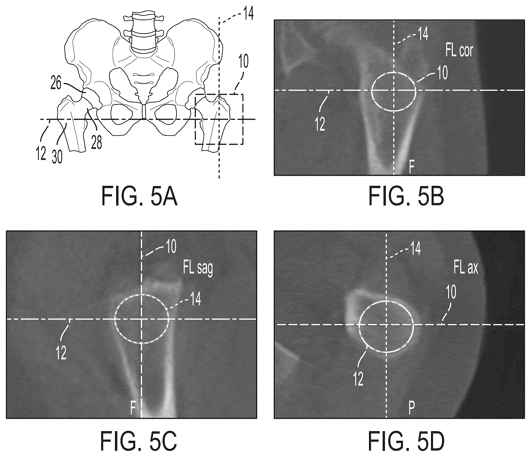 Patent US12496033 Figure 4 – For measuring the axial (transverse), coronal (frontal) and sagittal (bisection) alignment of a lower limb