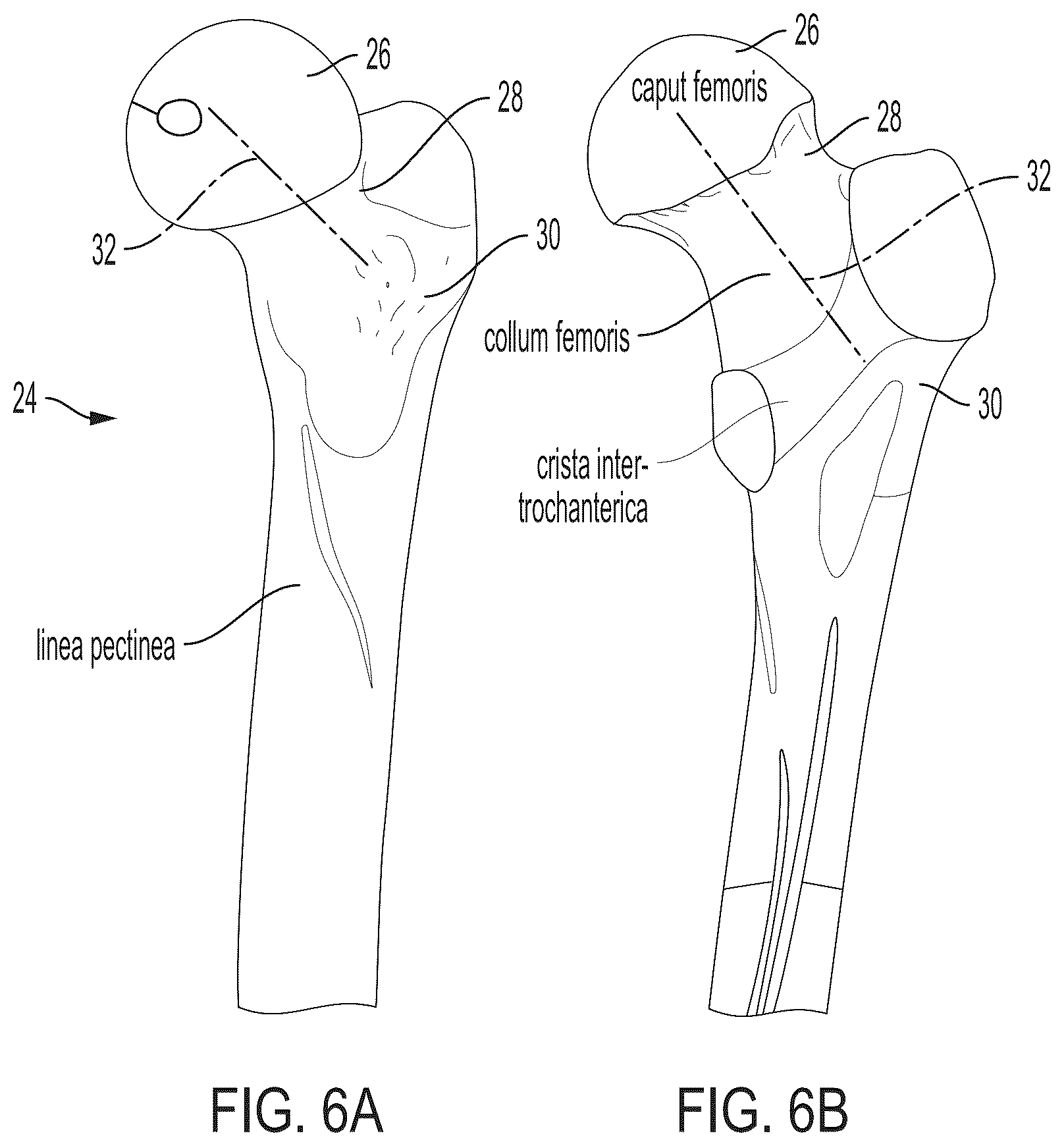 Patent US12496033 Figure 5 – For measuring the axial (transverse), coronal (frontal) and sagittal (bisection) alignment of a lower limb