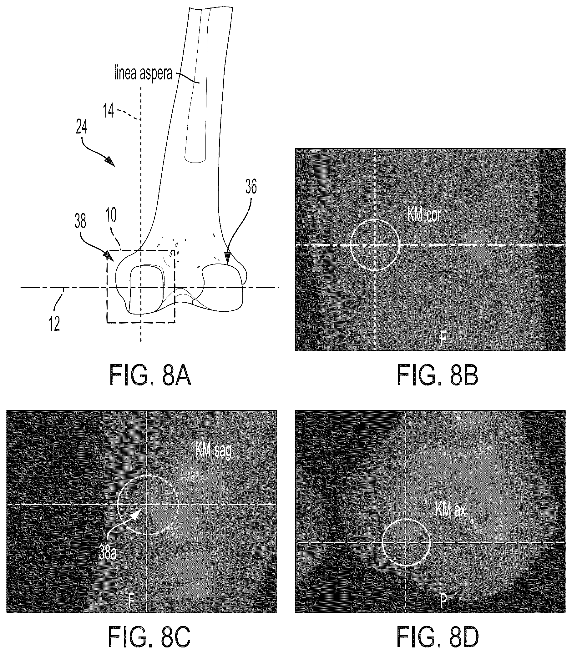 Patent US12496033 Figure 7 – For measuring the axial (transverse), coronal (frontal) and sagittal (bisection) alignment of a lower limb