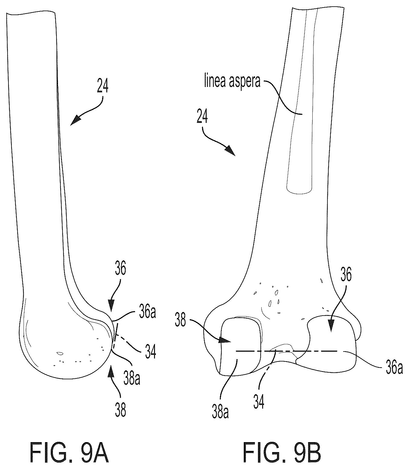 Patent US12496033 Figure 8 – For measuring the axial (transverse), coronal (frontal) and sagittal (bisection) alignment of a lower limb
