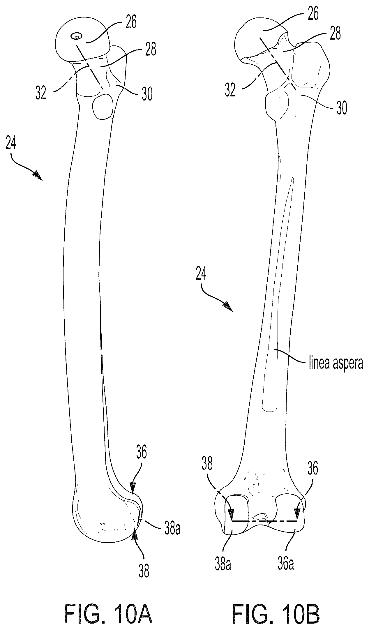 Patent US12496033 Figure 9 – For measuring the axial (transverse), coronal (frontal) and sagittal (bisection) alignment of a lower limb