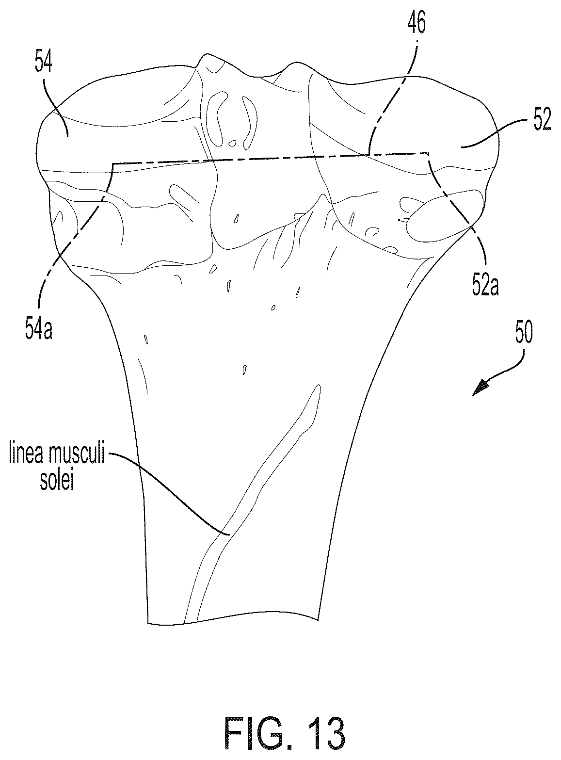 Patent US12496033 Figure 12 – For measuring the axial (transverse), coronal (frontal) and sagittal (bisection) alignment of a lower limb