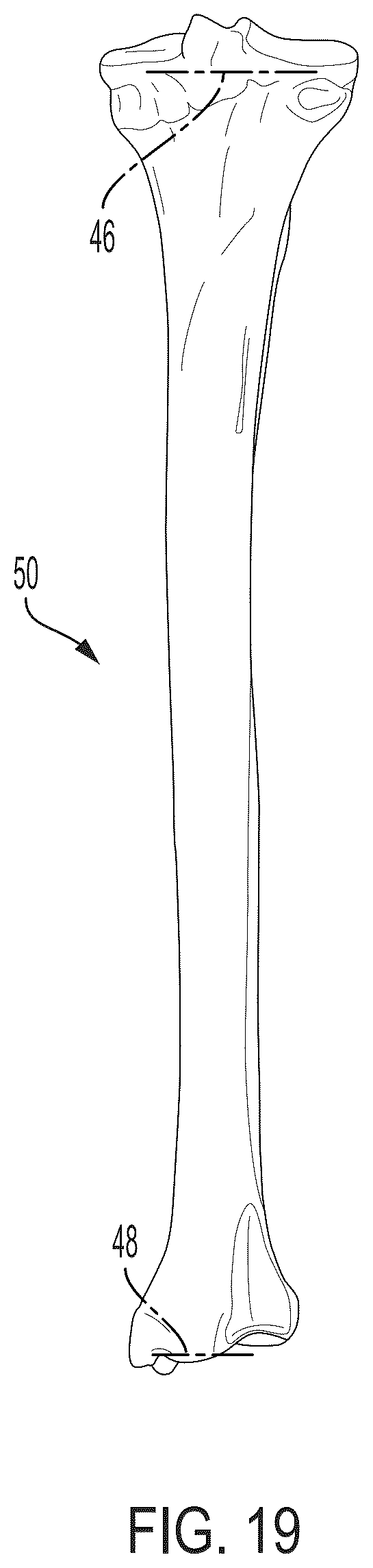 Patent US12496033 Figure 18 – For measuring the axial (transverse), coronal (frontal) and sagittal (bisection) alignment of a lower limb