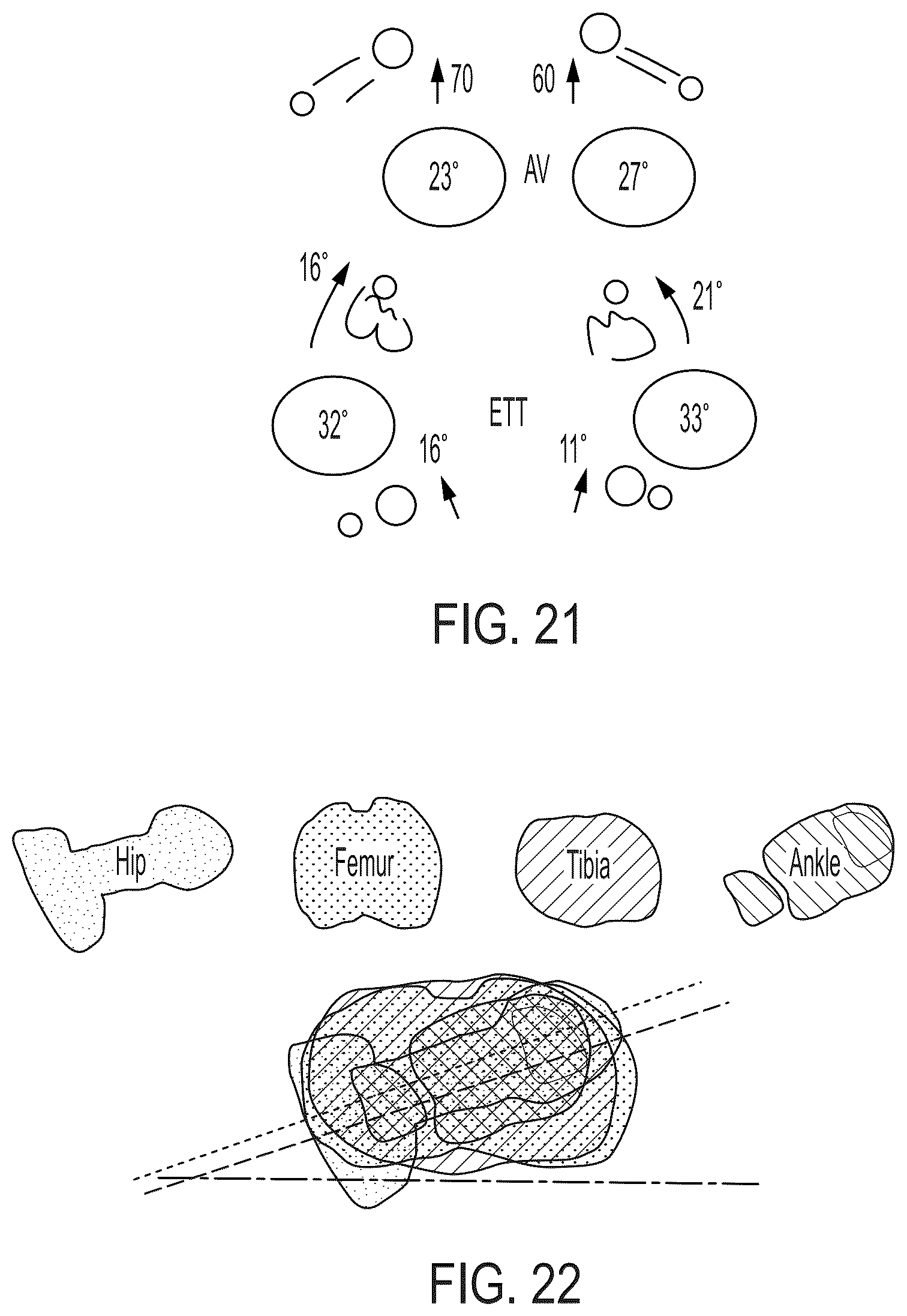 Patent US12496033 Figure 20 – For measuring the axial (transverse), coronal (frontal) and sagittal (bisection) alignment of a lower limb