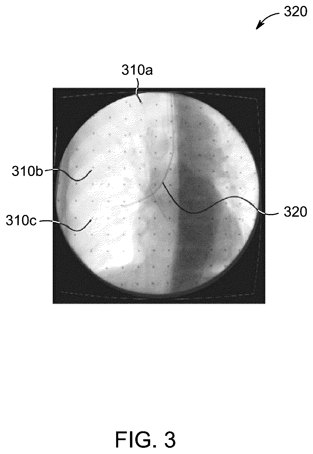Patent US12496035 Figure 4 – Systems and methods for C-arm fluoroscope camera pose refinement with secondary movement compensation