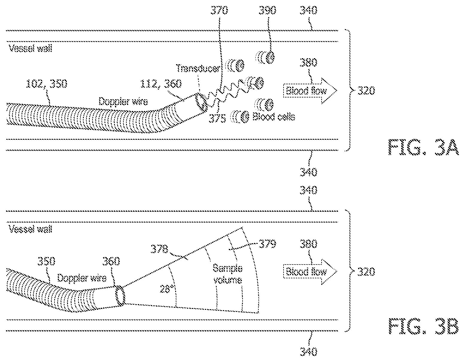Patent US12496036 Figure 3 – Physiology sensing intraluminal device with positioning guidance and associated devices, systems, and methods