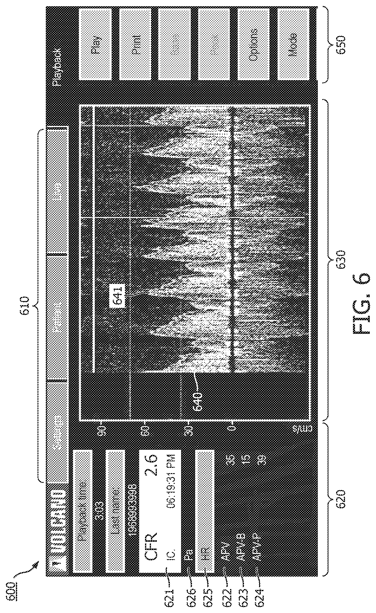 Patent US12496036 Figure 6 – Physiology sensing intraluminal device with positioning guidance and associated devices, systems, and methods