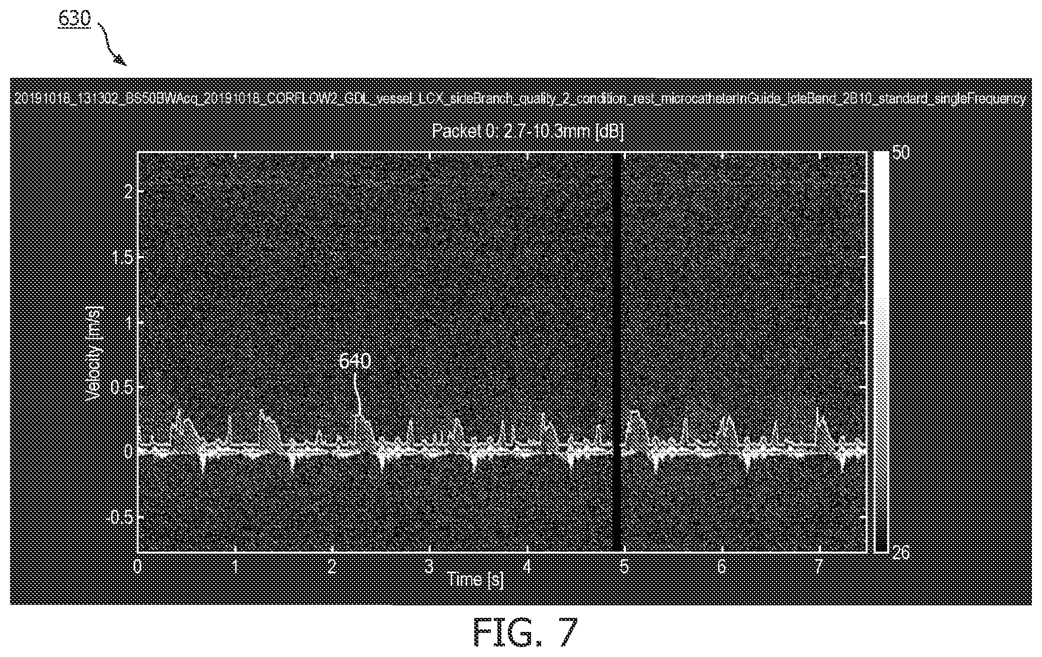 Patent US12496036 Figure 7 – Physiology sensing intraluminal device with positioning guidance and associated devices, systems, and methods