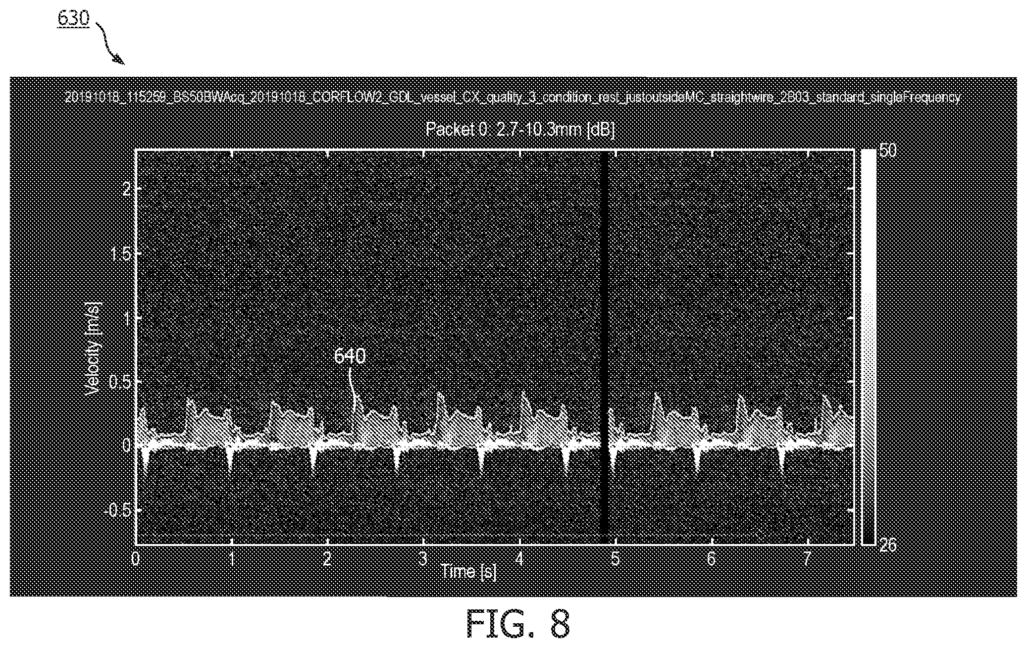 Patent US12496036 Figure 8 – Physiology sensing intraluminal device with positioning guidance and associated devices, systems, and methods