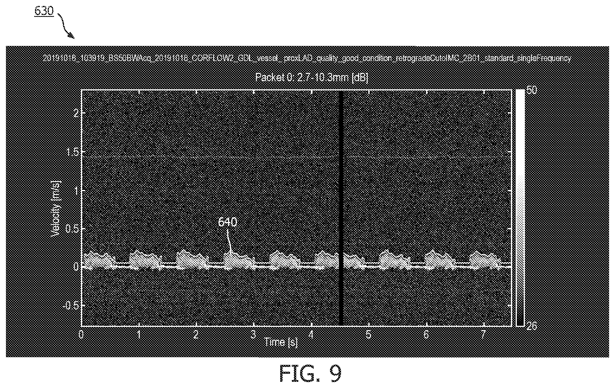 Patent US12496036 Figure 9 – Physiology sensing intraluminal device with positioning guidance and associated devices, systems, and methods