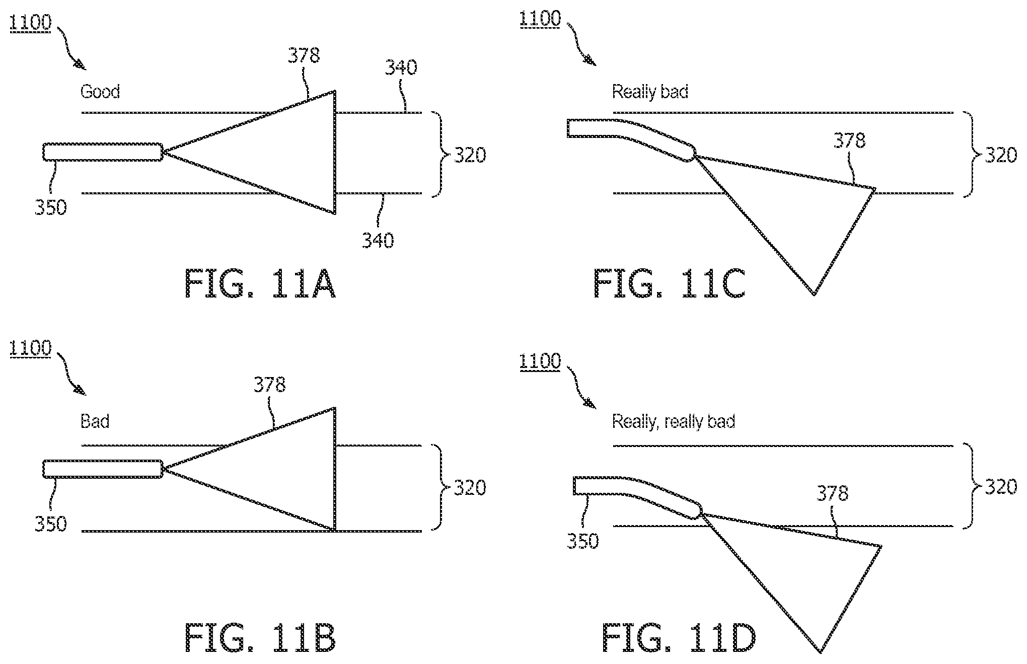 Patent US12496036 Figure 11 – Physiology sensing intraluminal device with positioning guidance and associated devices, systems, and methods