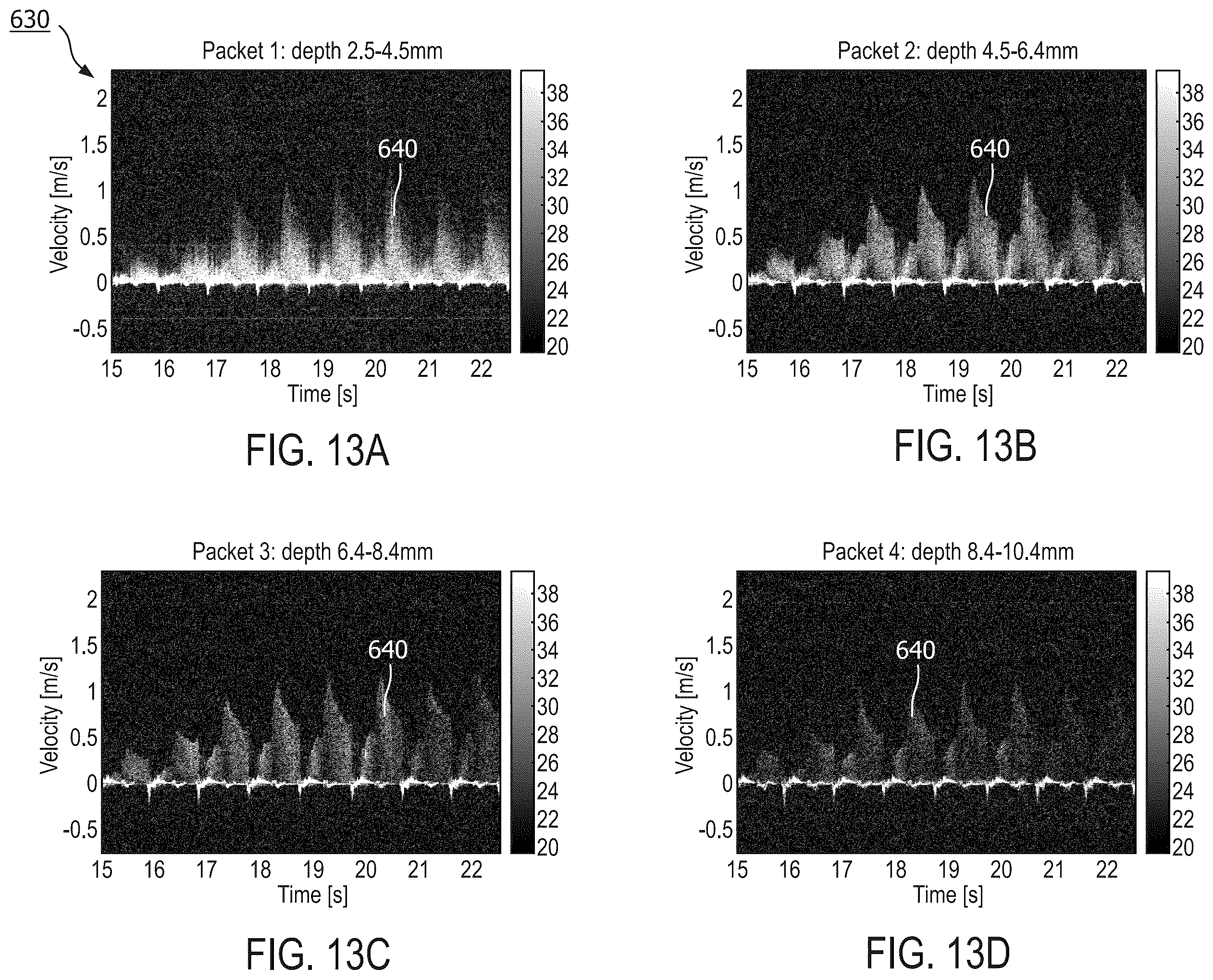 Patent US12496036 Figure 13 – Physiology sensing intraluminal device with positioning guidance and associated devices, systems, and methods