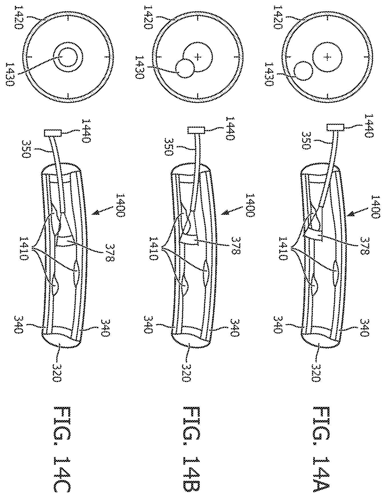 Patent US12496036 Figure 14 – Physiology sensing intraluminal device with positioning guidance and associated devices, systems, and methods