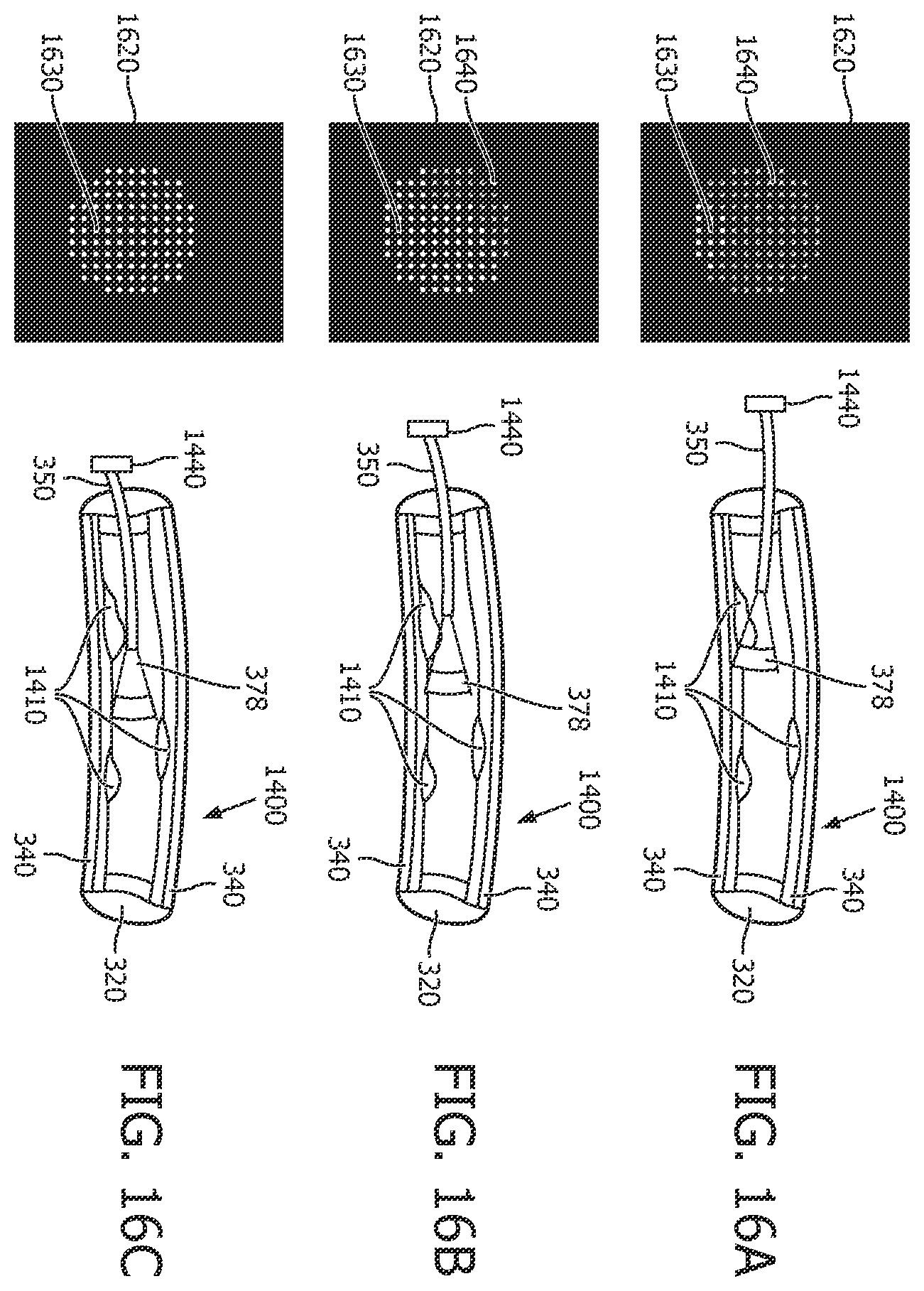 Patent US12496036 Figure 16 – Physiology sensing intraluminal device with positioning guidance and associated devices, systems, and methods